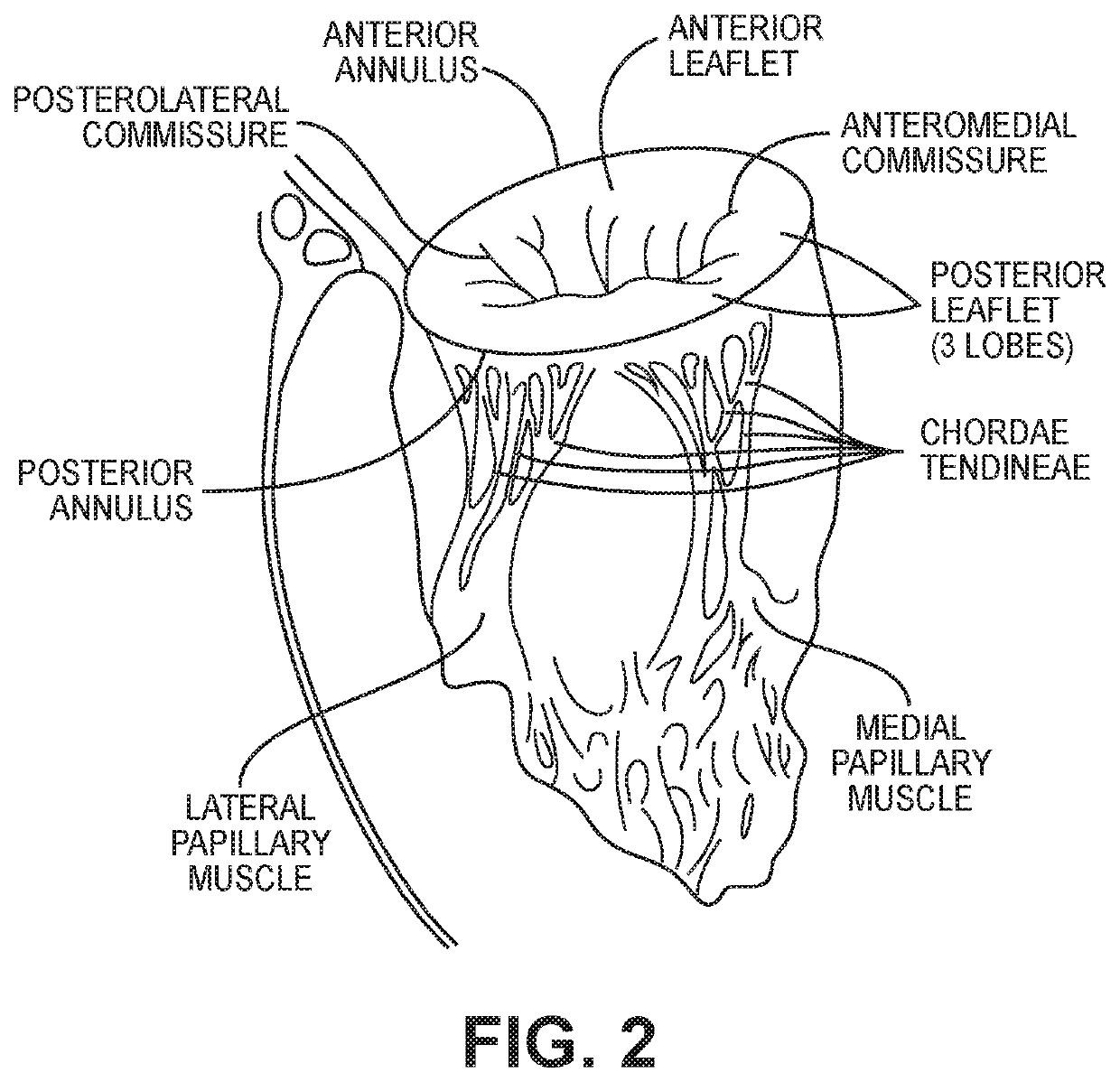 Hydrophilic skirt for paravalvular leak mitigation and fit and apposition optimization for prosthetic heart valve implants
