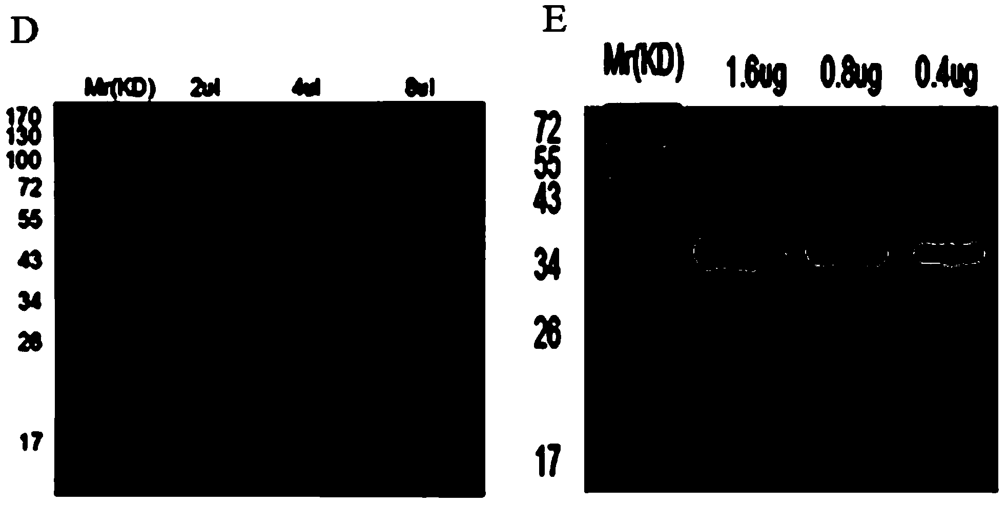 Interleukin 37 containing drug, preparation method and application thereof
