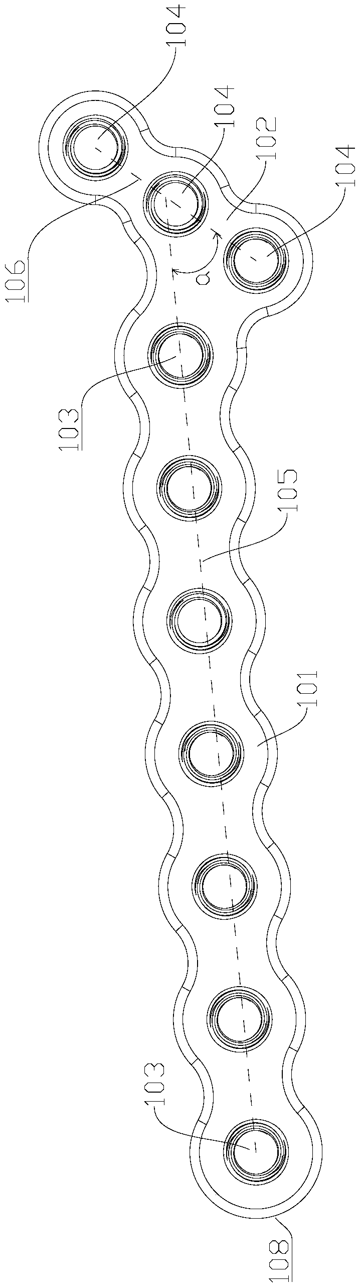 Scapular locking plate and scapular locking method