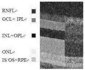 Registration method of three-dimensional non-rigid optical coherence tomographic image