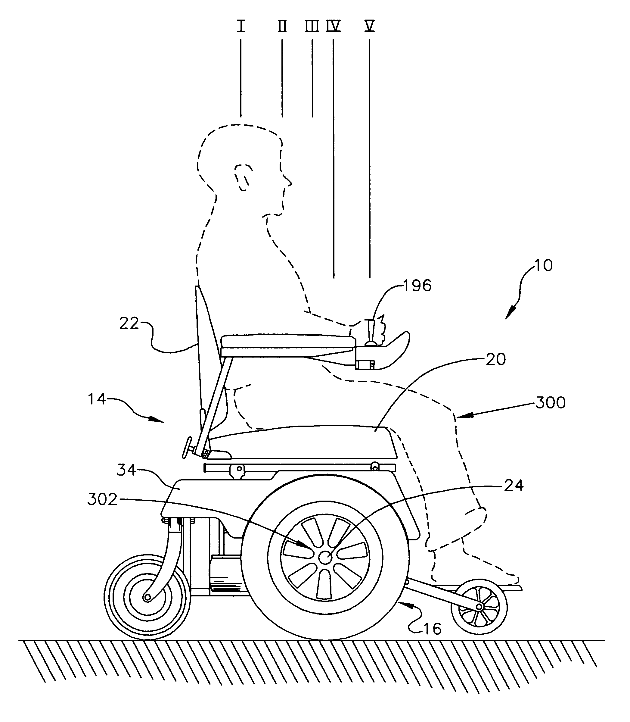 Curb-climbing power wheelchair