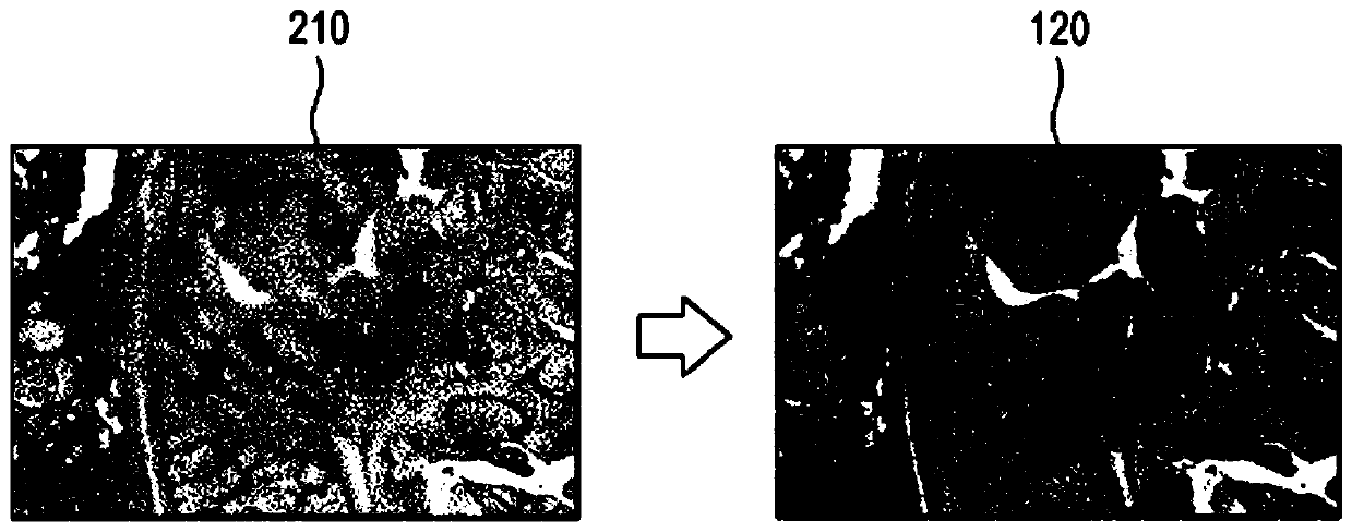 Method and apparatus for processing histological image captured by medical imaging device
