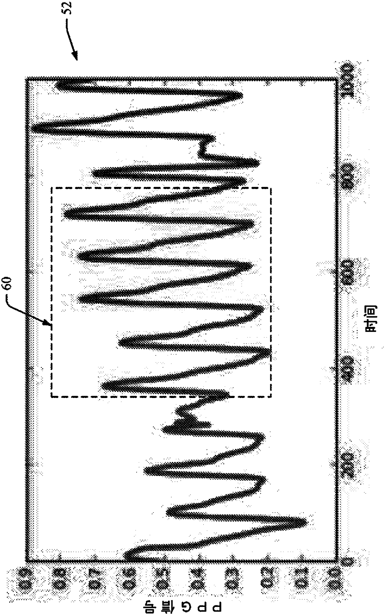 Method to quantify photoplethysmogram (PPG) signal quality