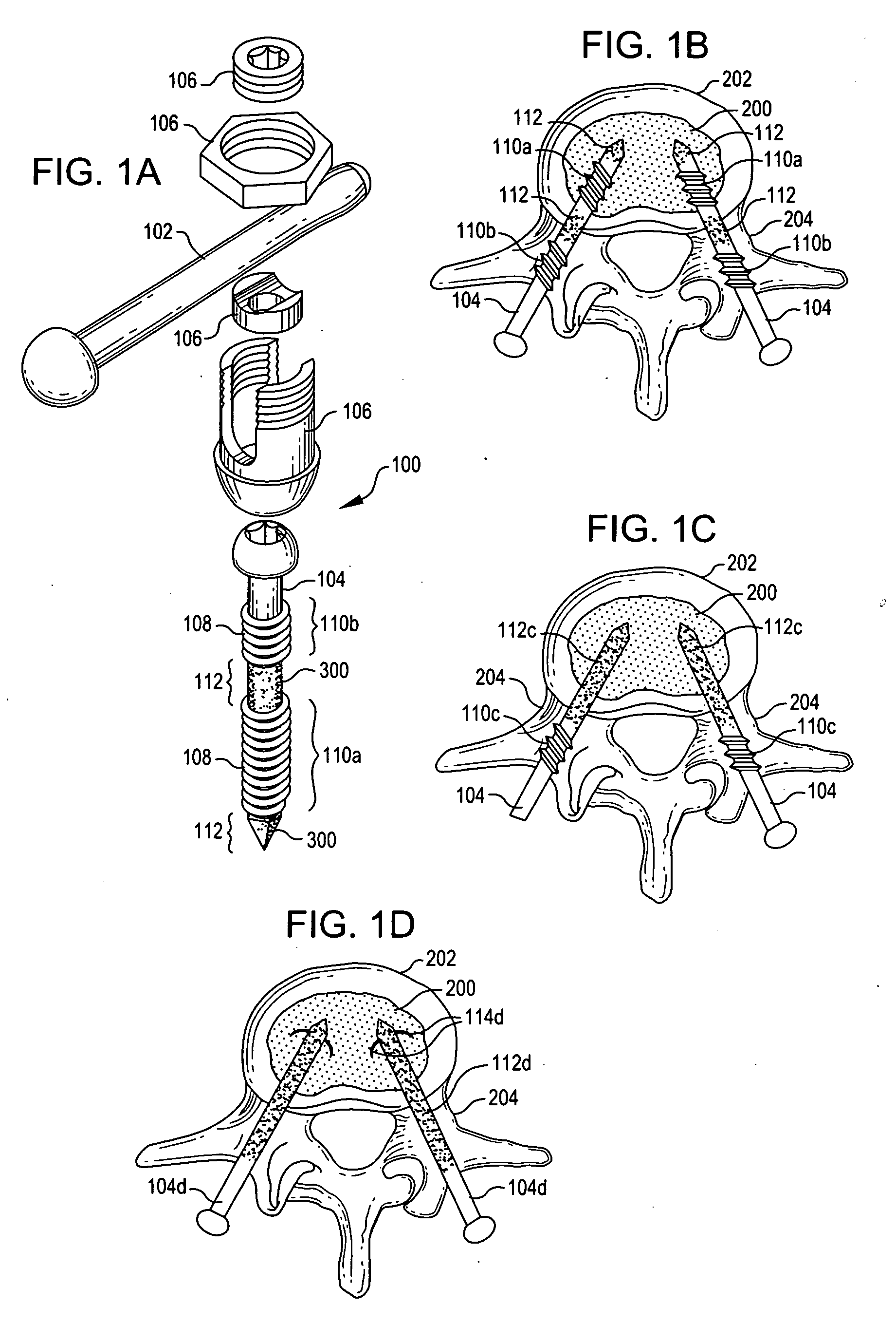 Methods and devices for improved bonding of devices to bone
