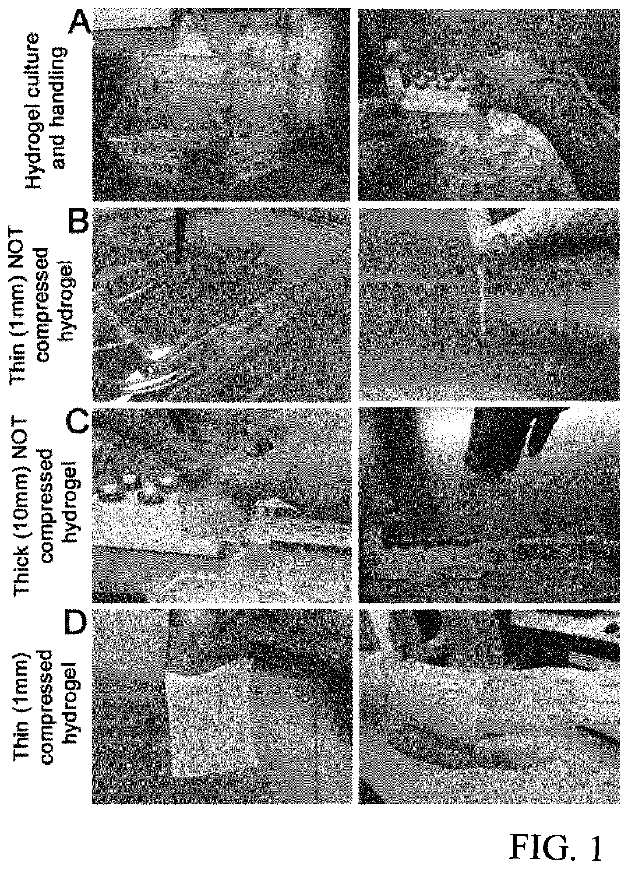 Tissue graft