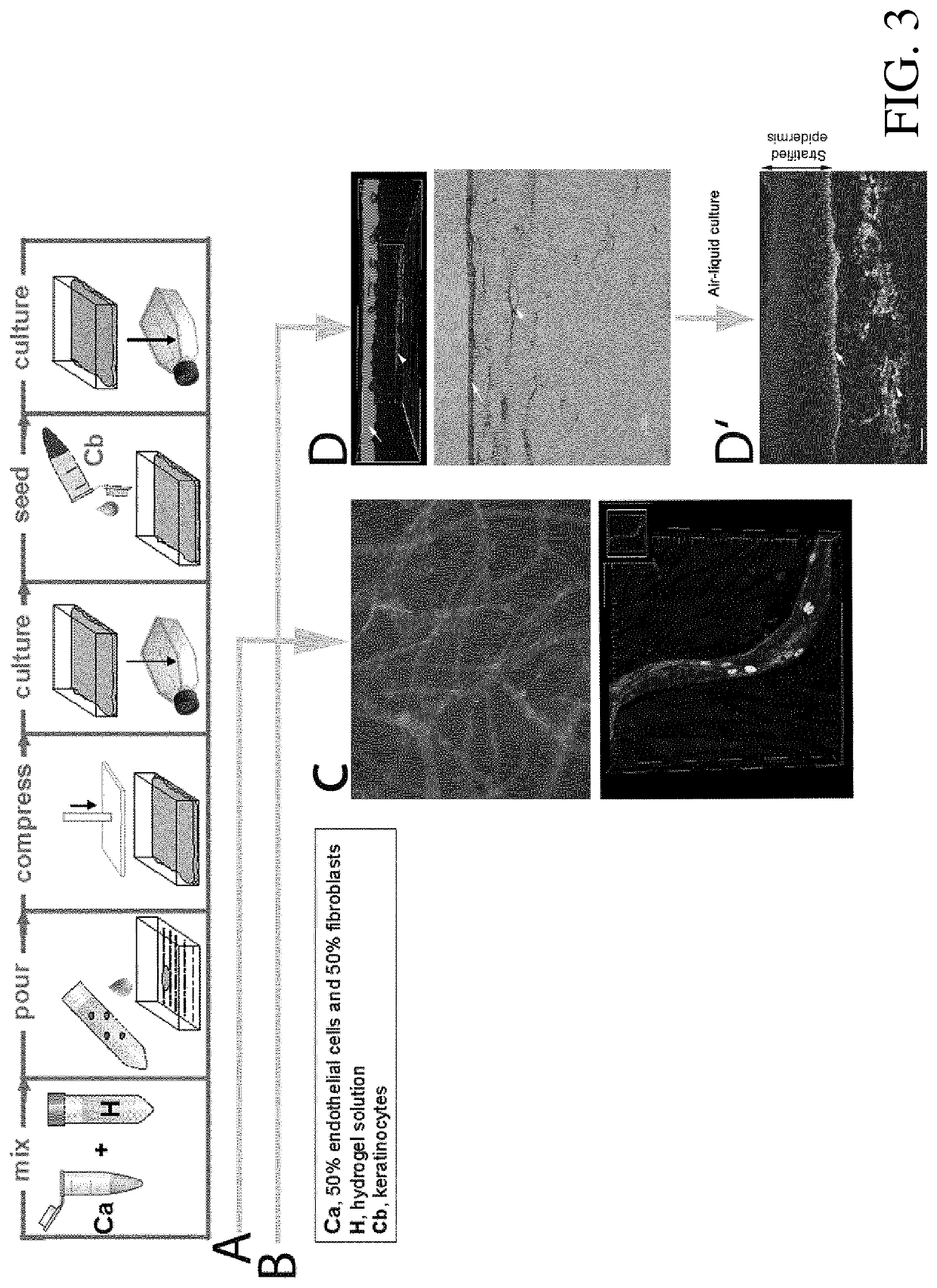 Tissue graft