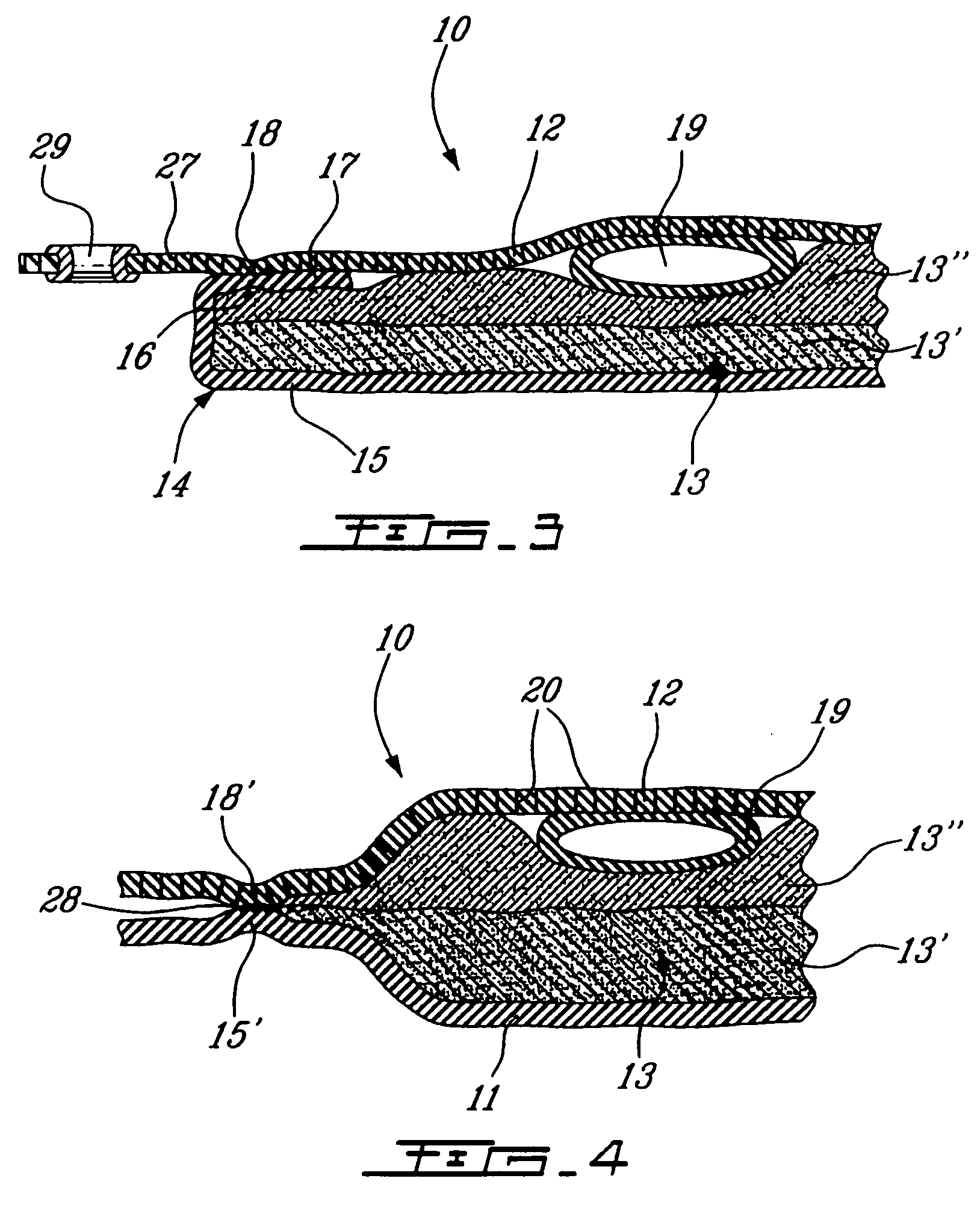 Irrigation mat and method of use