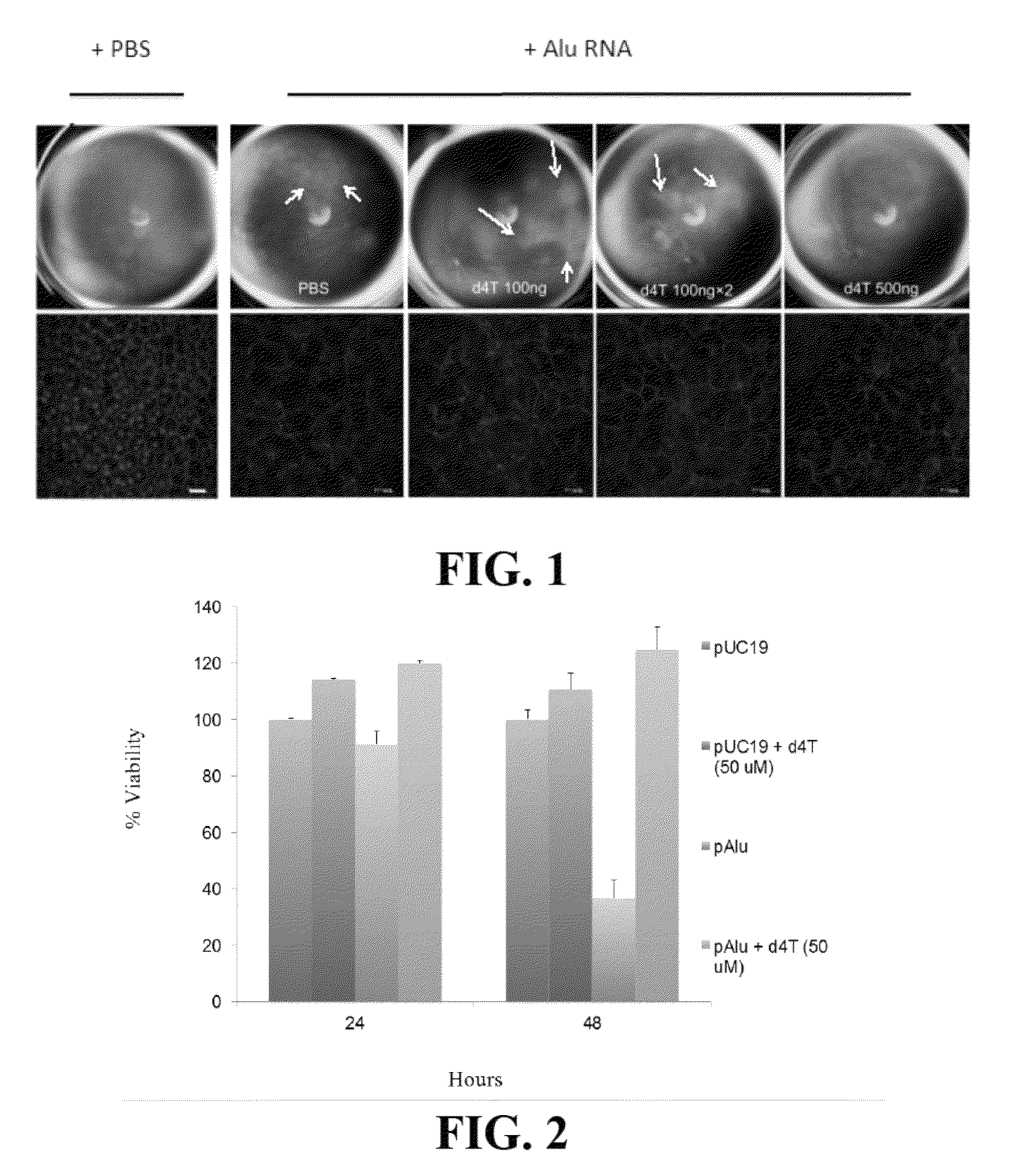 Compositions and methods for treating retinal degradation