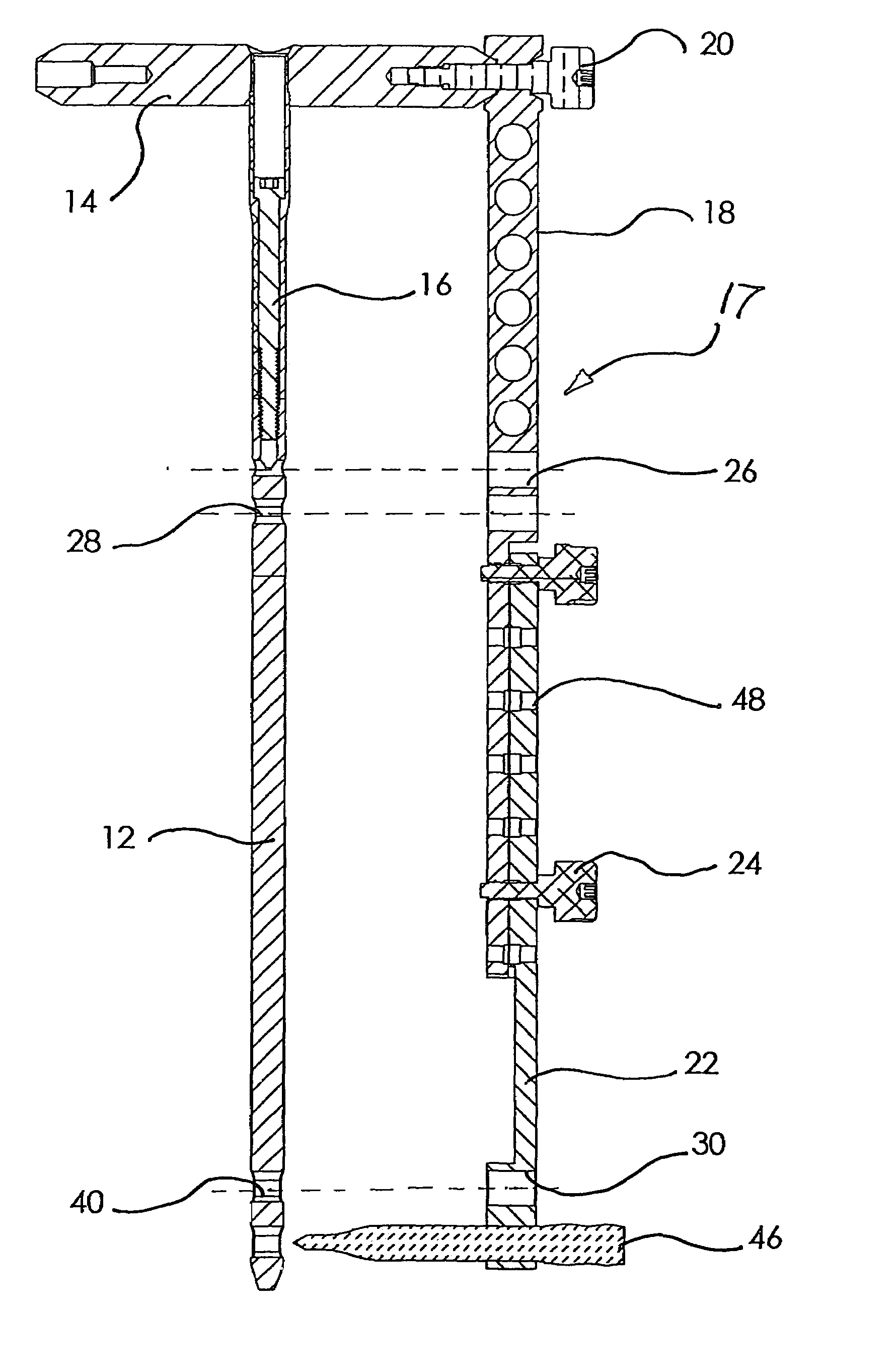 Method and apparatus for locating and stabilizing an orthopedic implant