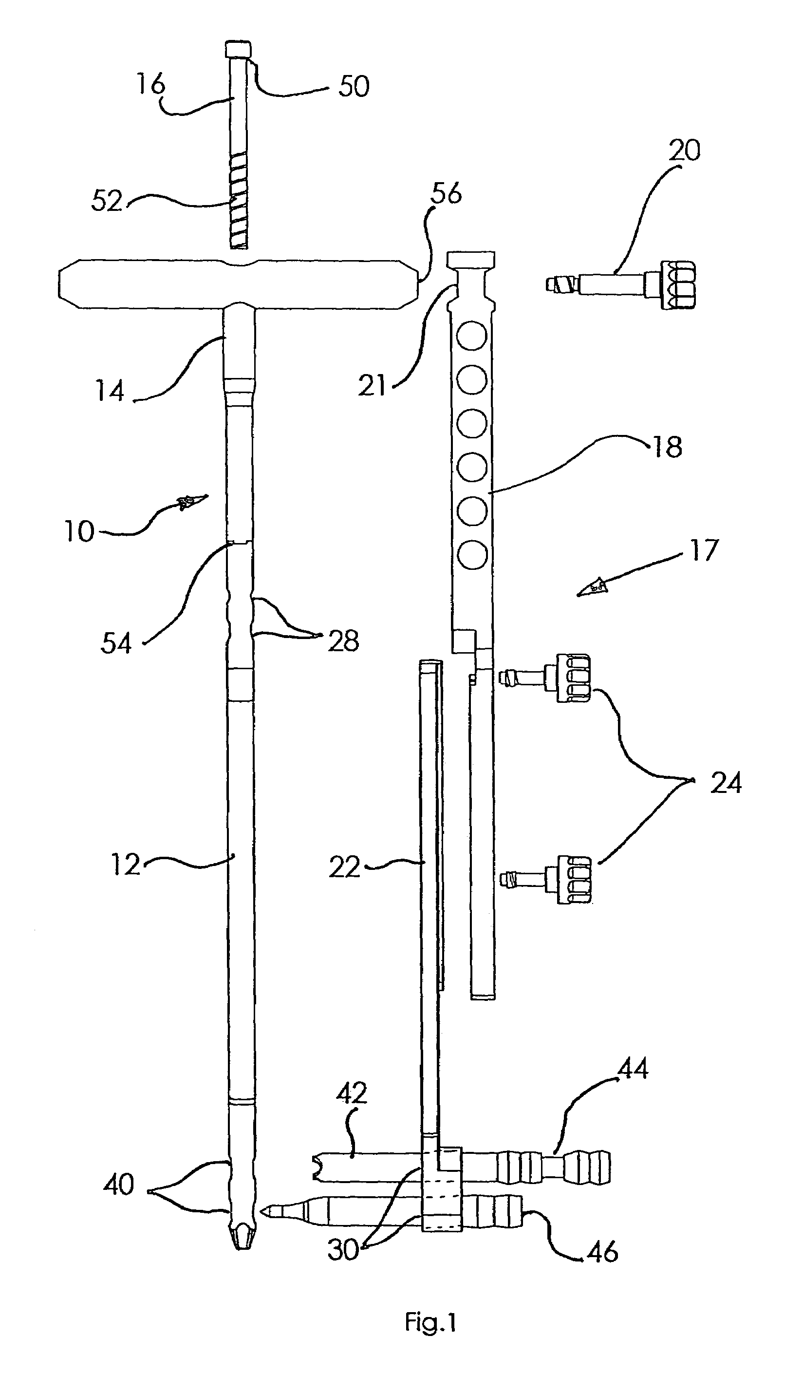 Method and apparatus for locating and stabilizing an orthopedic implant
