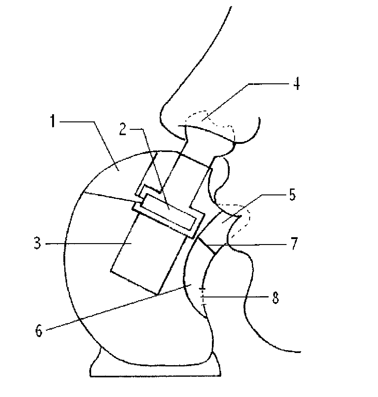 Aerosol therapy device with high frequency delivery