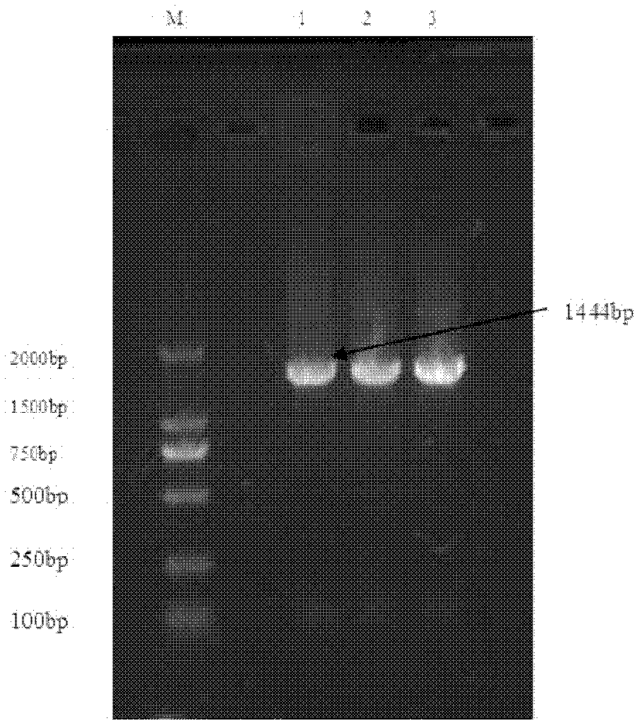 Oxalic acid degrading bacterium NJODL1 and application thereof