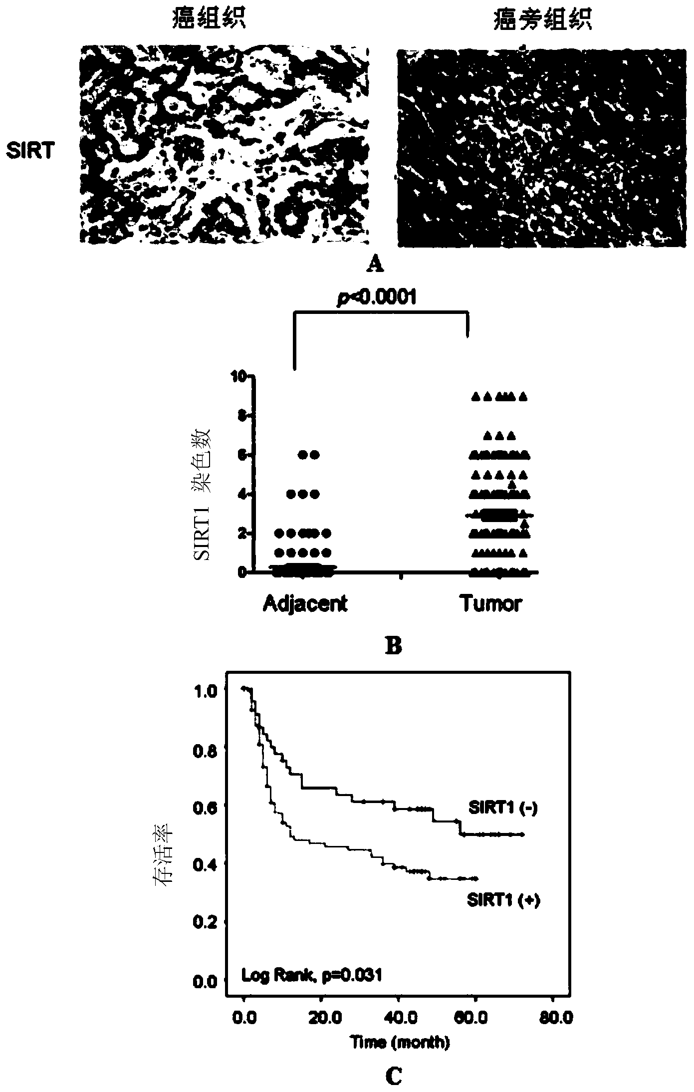 Application of SIRT1 inhibitor and sorafenib in preparing medicaments for treating liver cancer