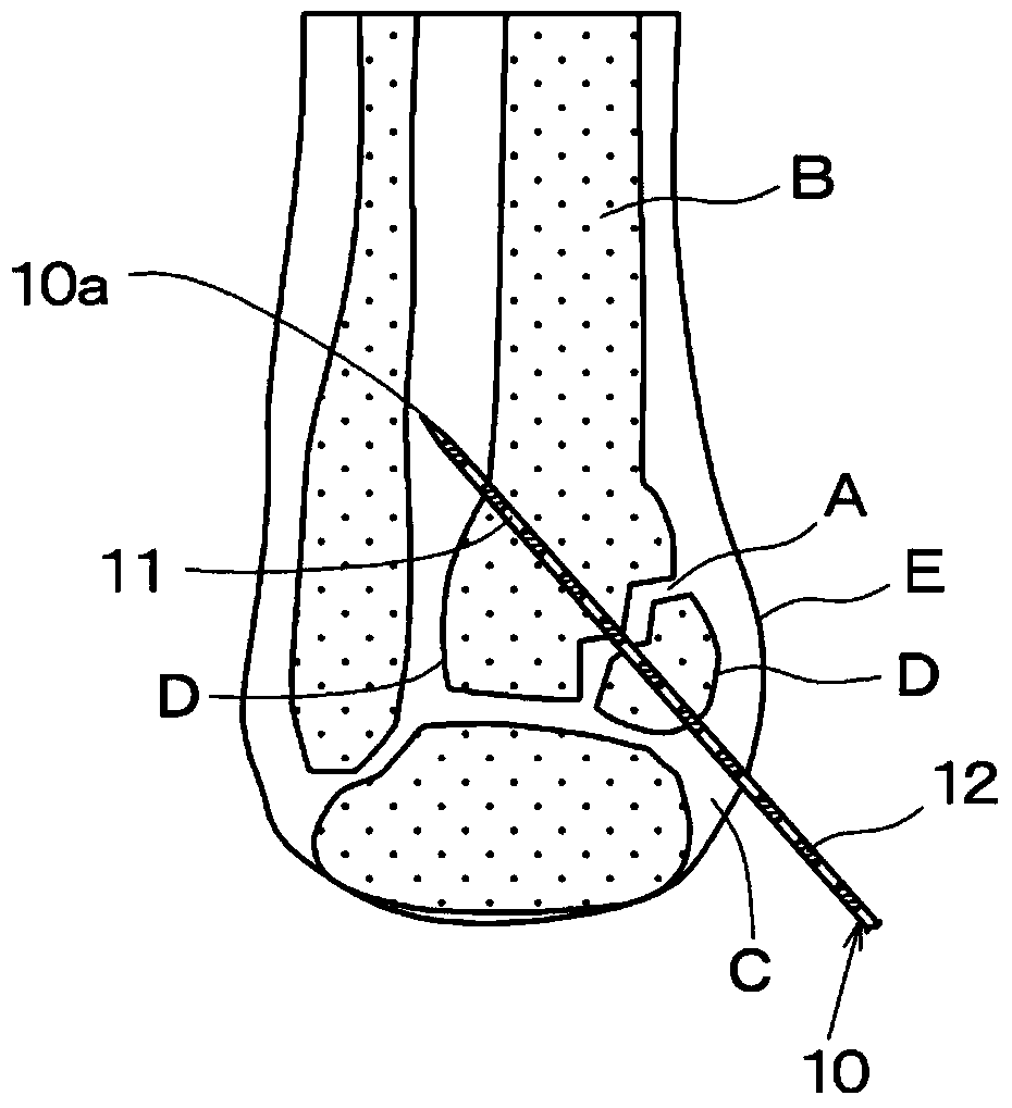 Graduated guide pin for use in medical treatment