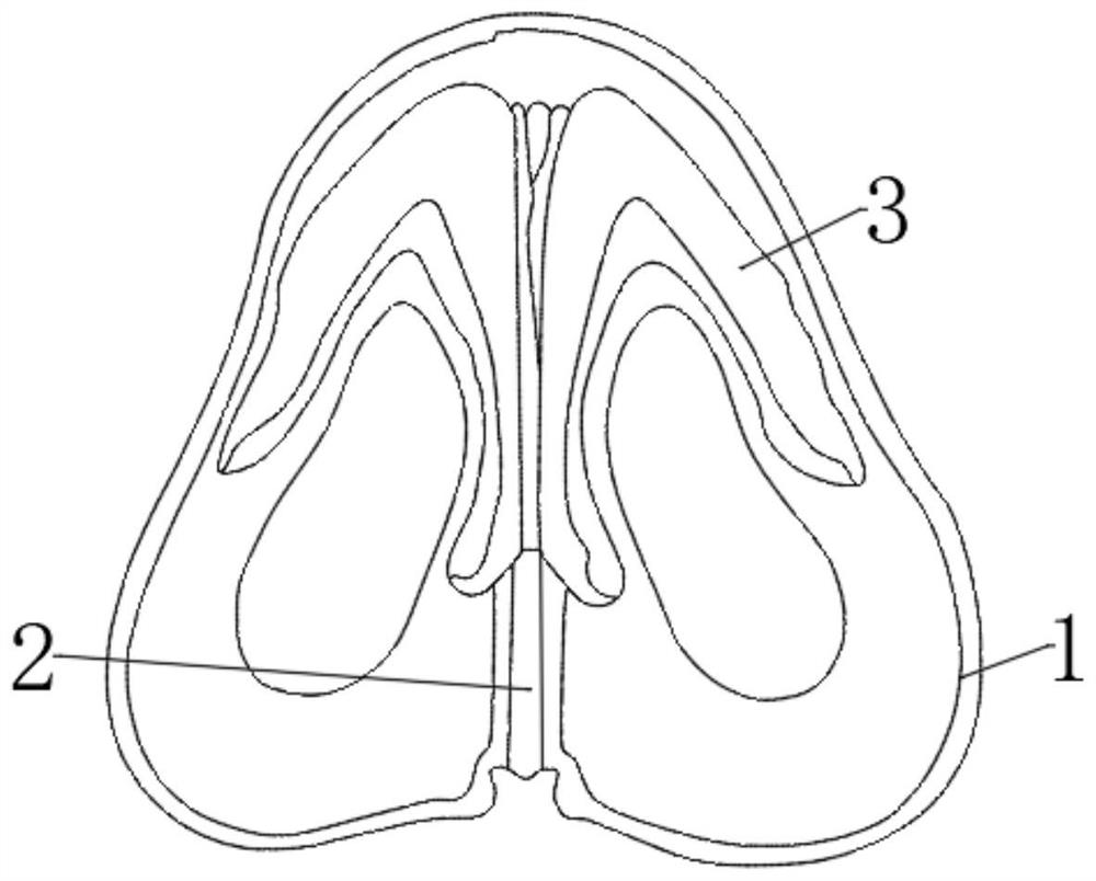 M-shaped bionic fornix stent and building method thereof