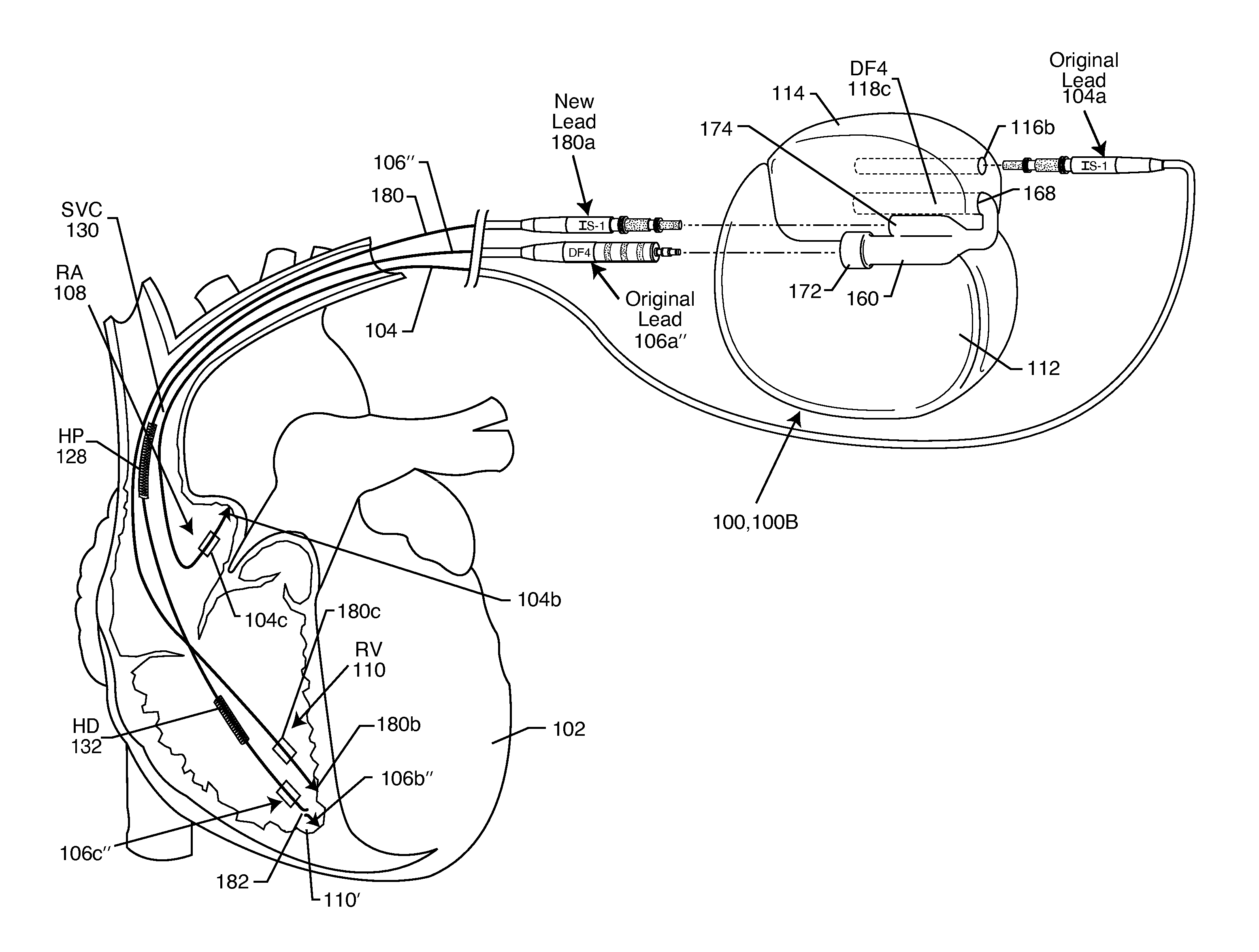 Secondary header for an implantable medical device incorporating an ISO DF4 connector and connector cavity and/or an IS4 connector and connector cavity