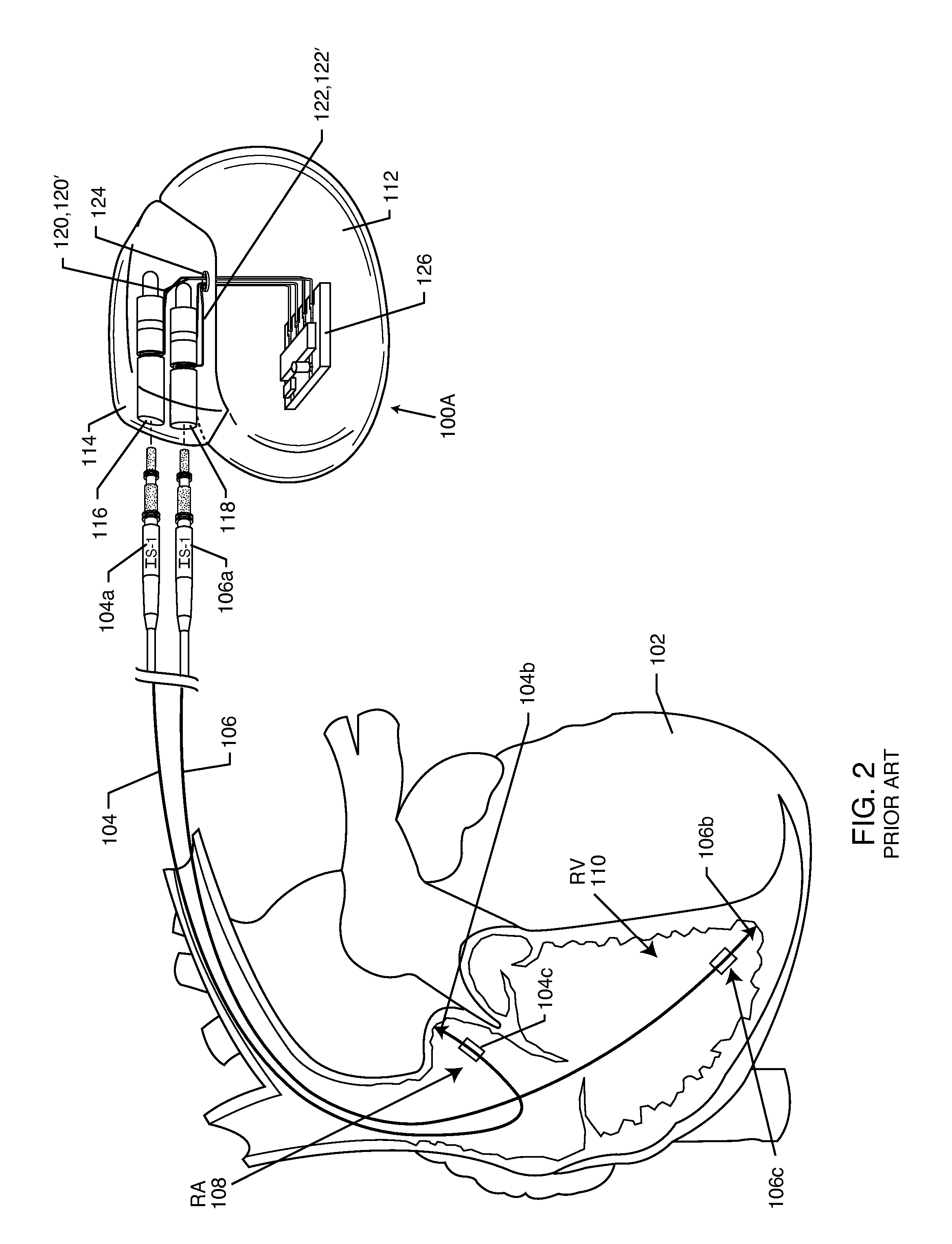 Secondary header for an implantable medical device incorporating an ISO DF4 connector and connector cavity and/or an IS4 connector and connector cavity
