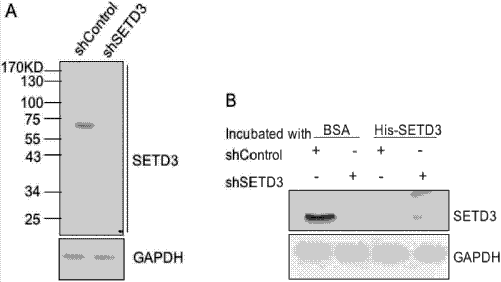 Preparation method of SETD3 antibody for immunofluorescence assay