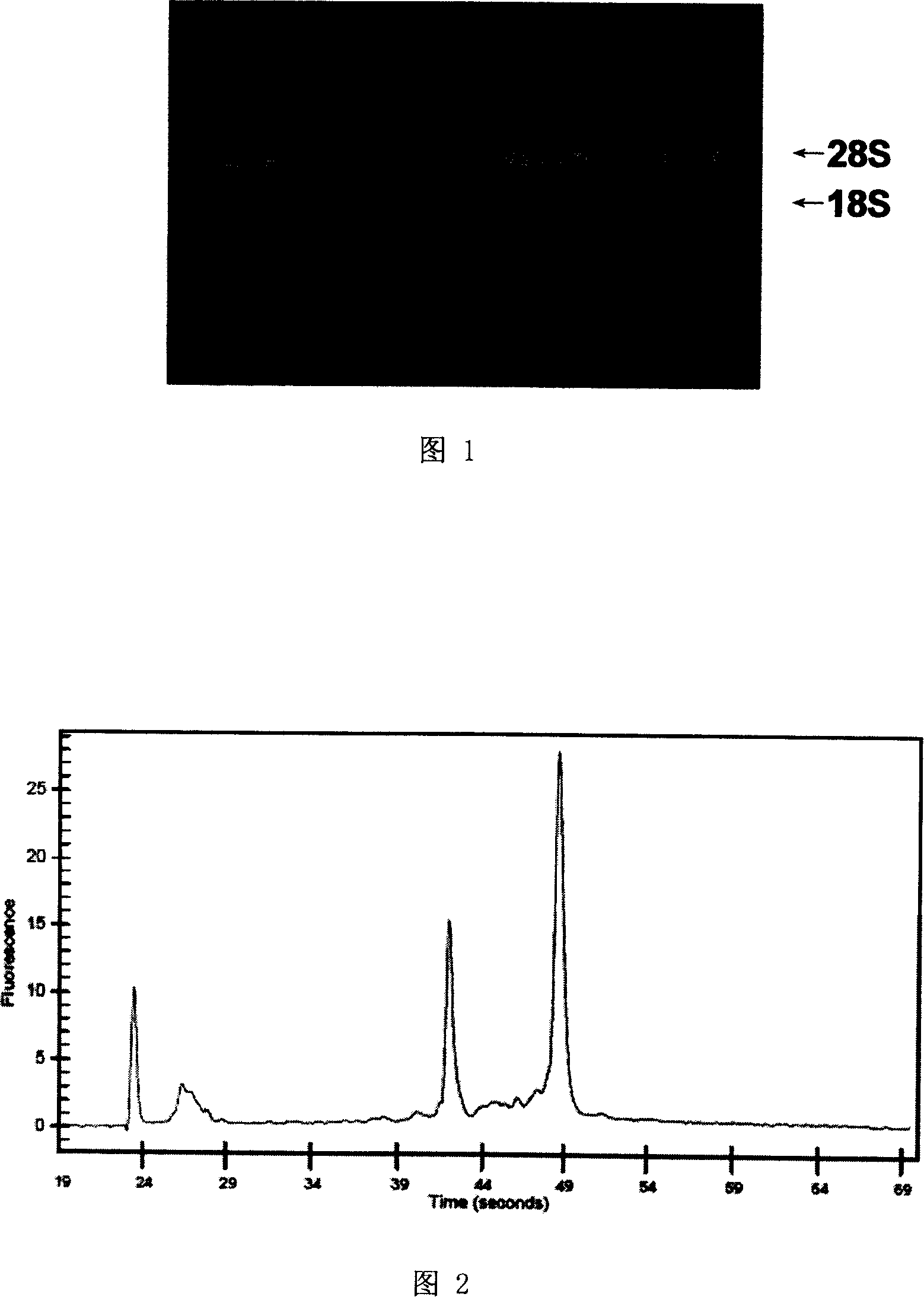 Gastric cancer auxiliary diagnosis gene order and application thereof