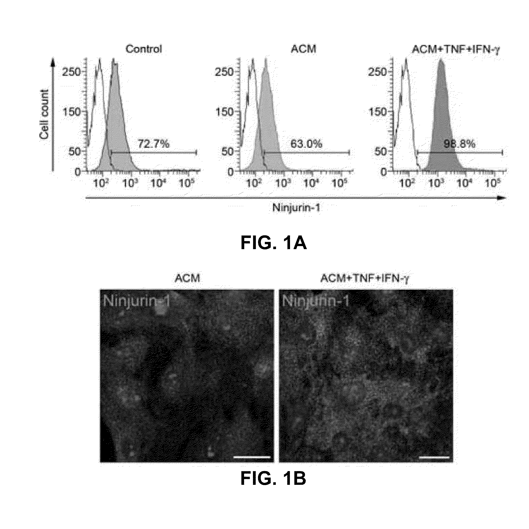 Ninjurin-1 modulation and uses thereof