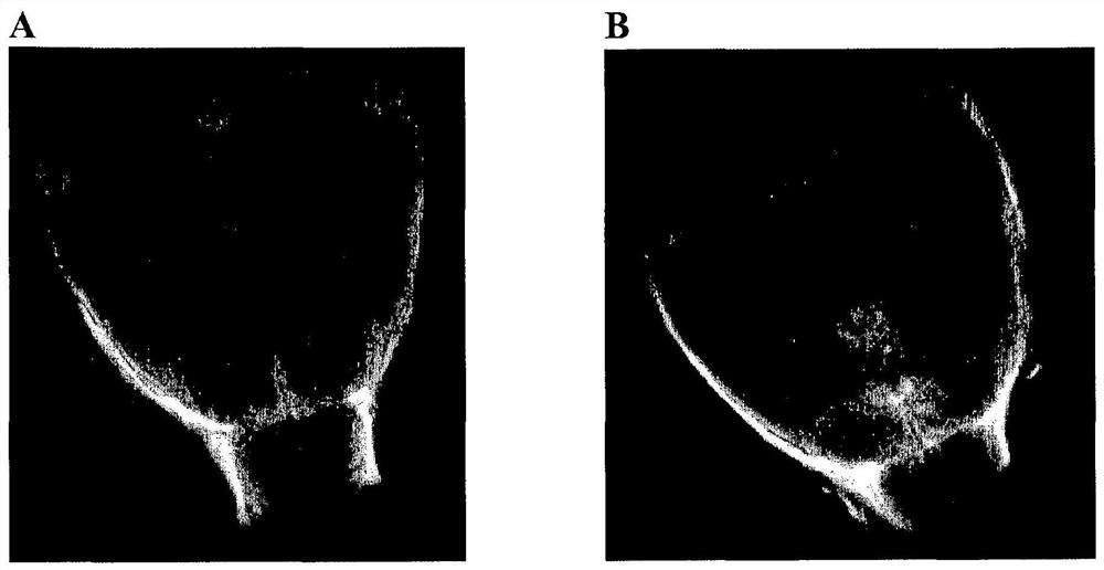 Formulations comprising solvent/detergent treated plasma (s/d plasma) and uses thereof