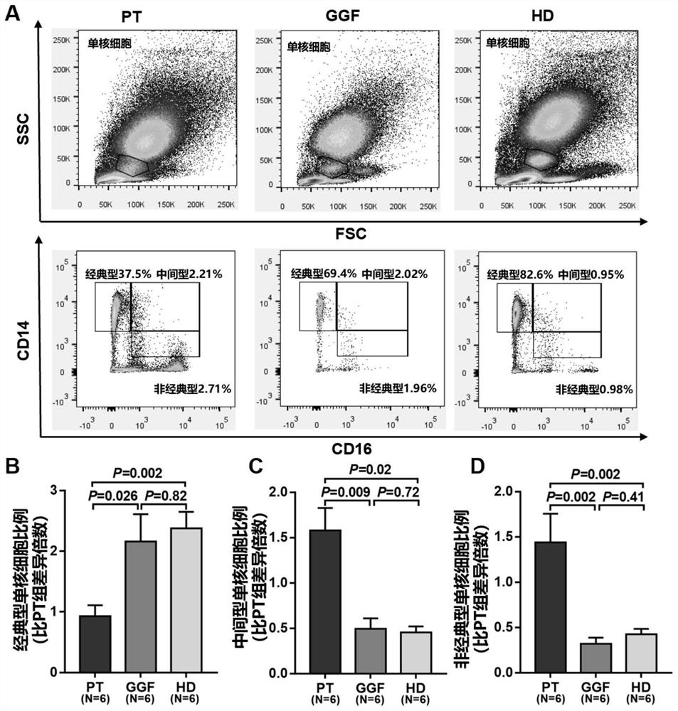 Macrophage polarization regulator and application thereof in promoting platelet generation