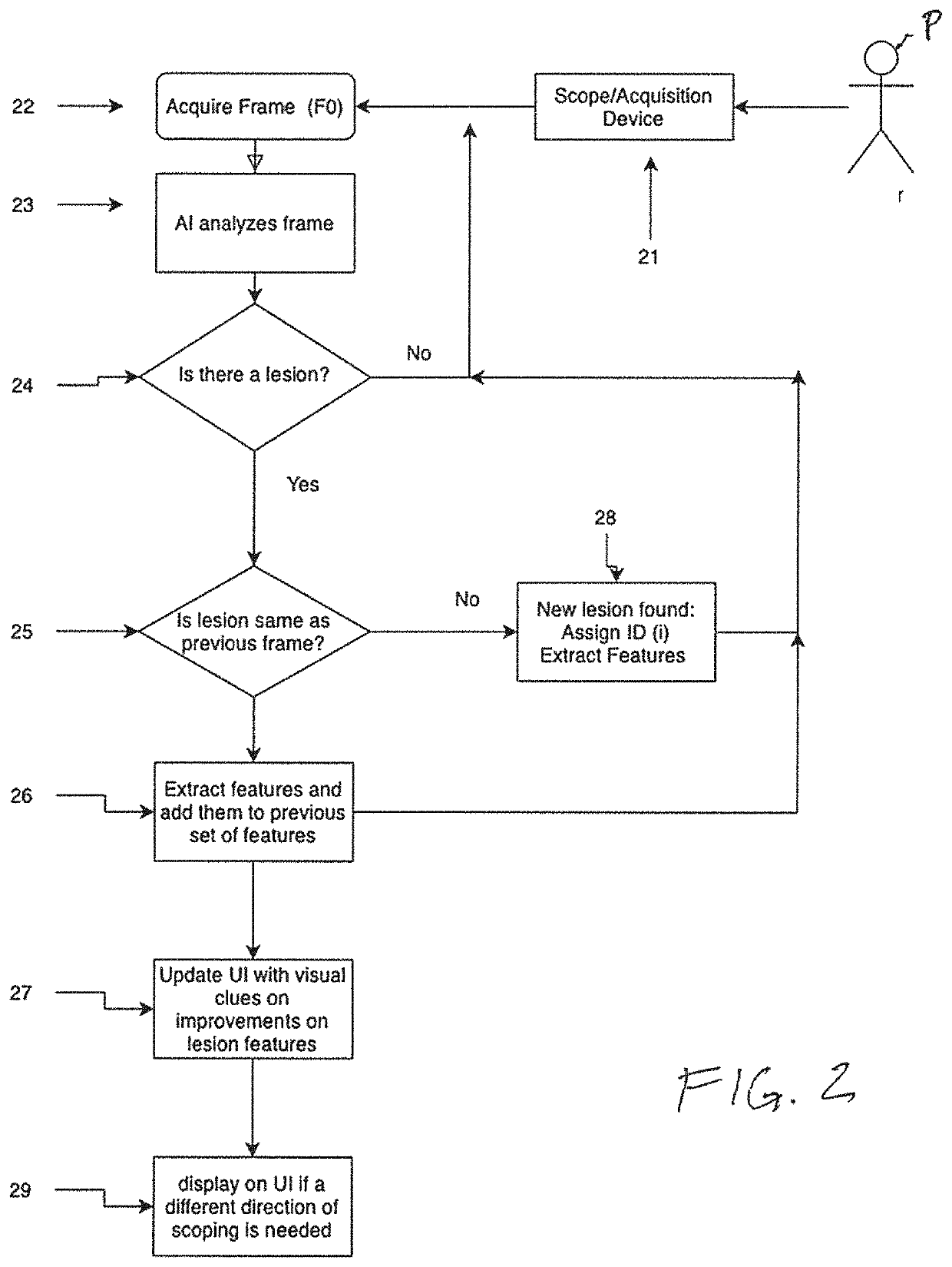 System and methods for aggregating features in video frames to improve accuracy of AI detection algorithms