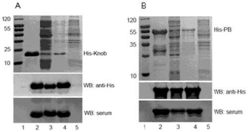 Canine adenovirus type I subunit vaccine and preparation method thereof