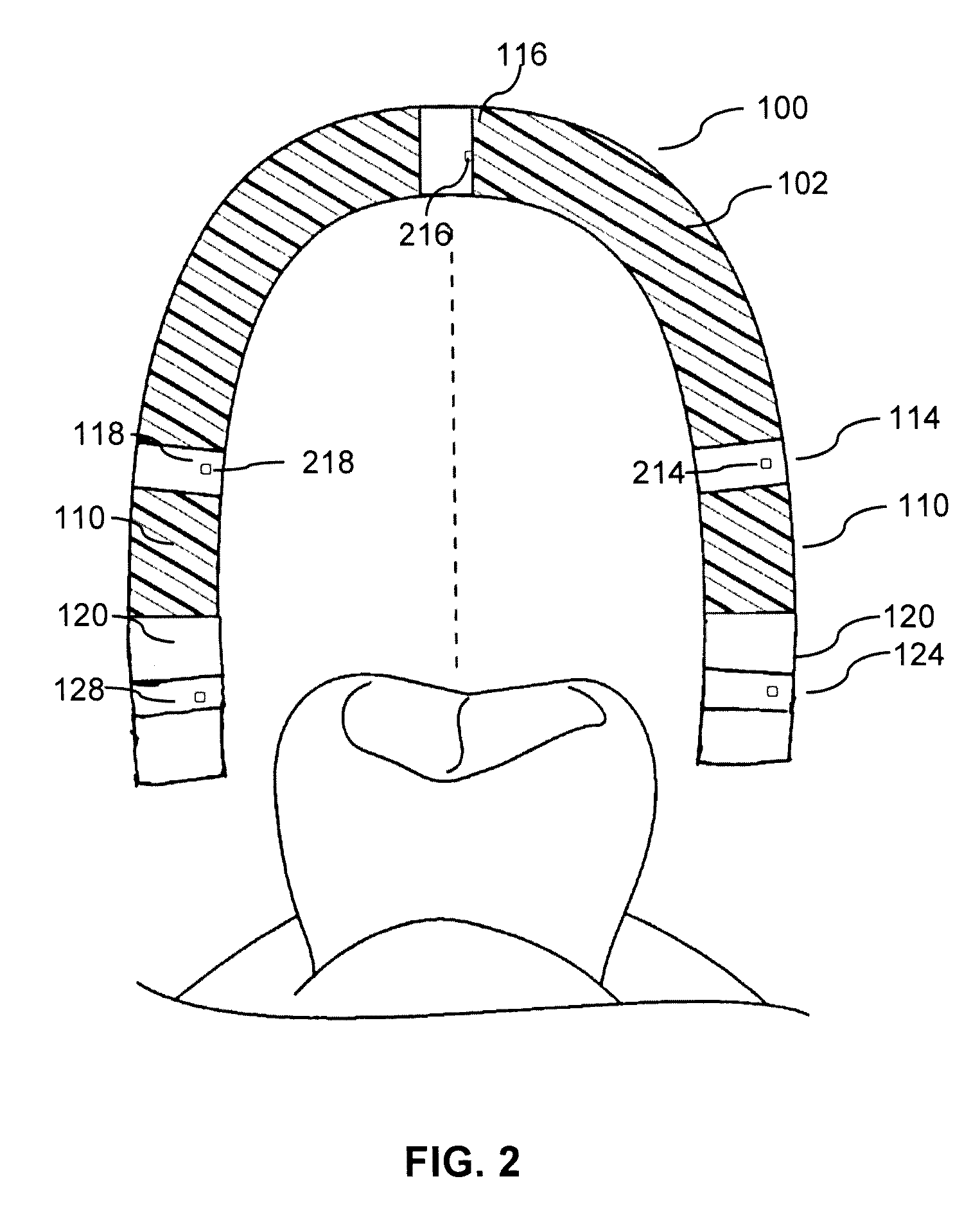 Apparatus and system for oxidative therapy in dentistry