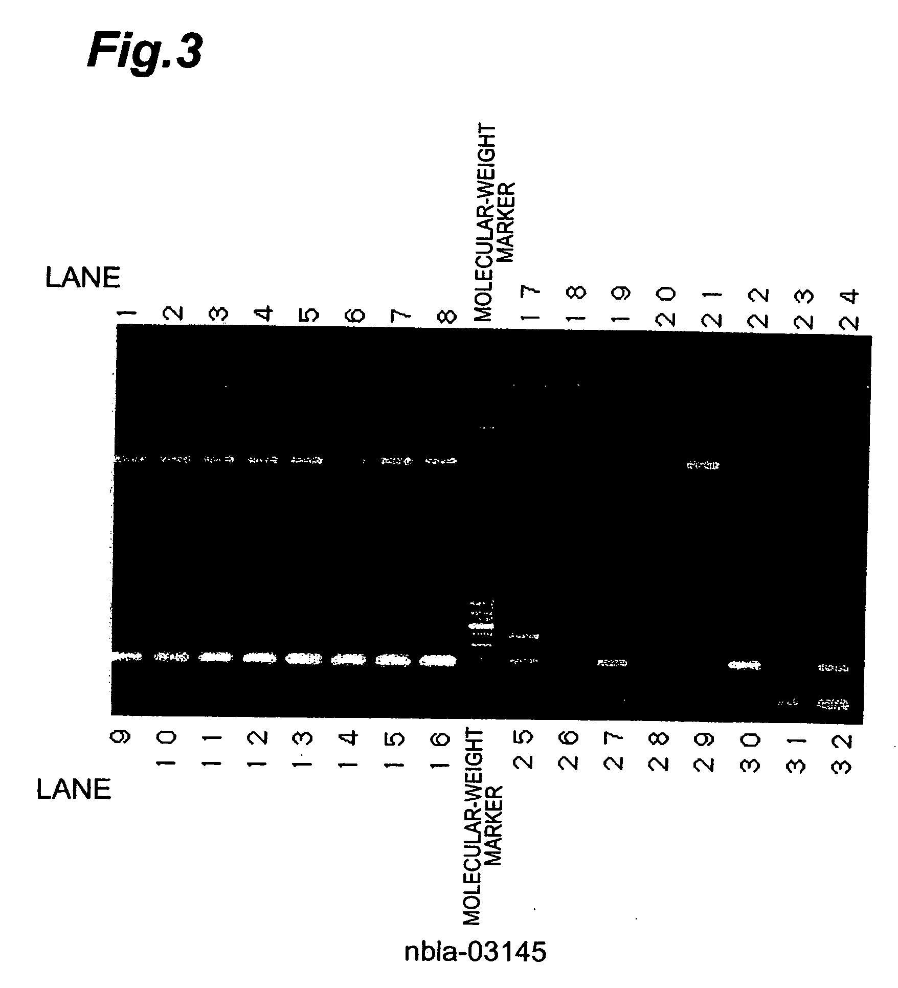 Nucleic acid sequences having characteristics of enhanced expression in human neuroblastoma with favorable prognosis based on comparison between human neuroblastoma with favorable prognosis and human neuroblastoma with unfavorable prognosis