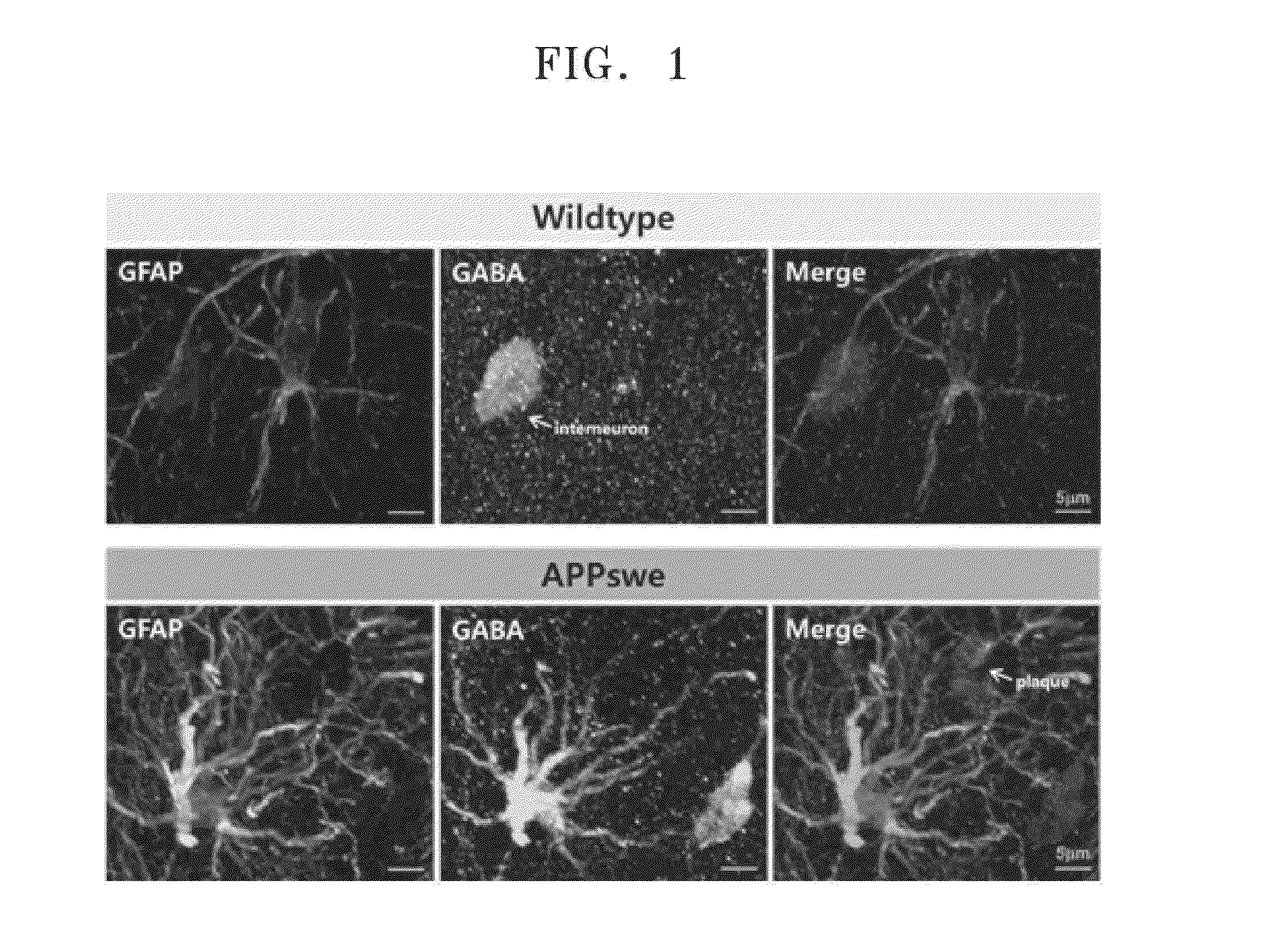 Pharmaceutical compositions for preventing or treating degenerative brain disease and method of screening the same