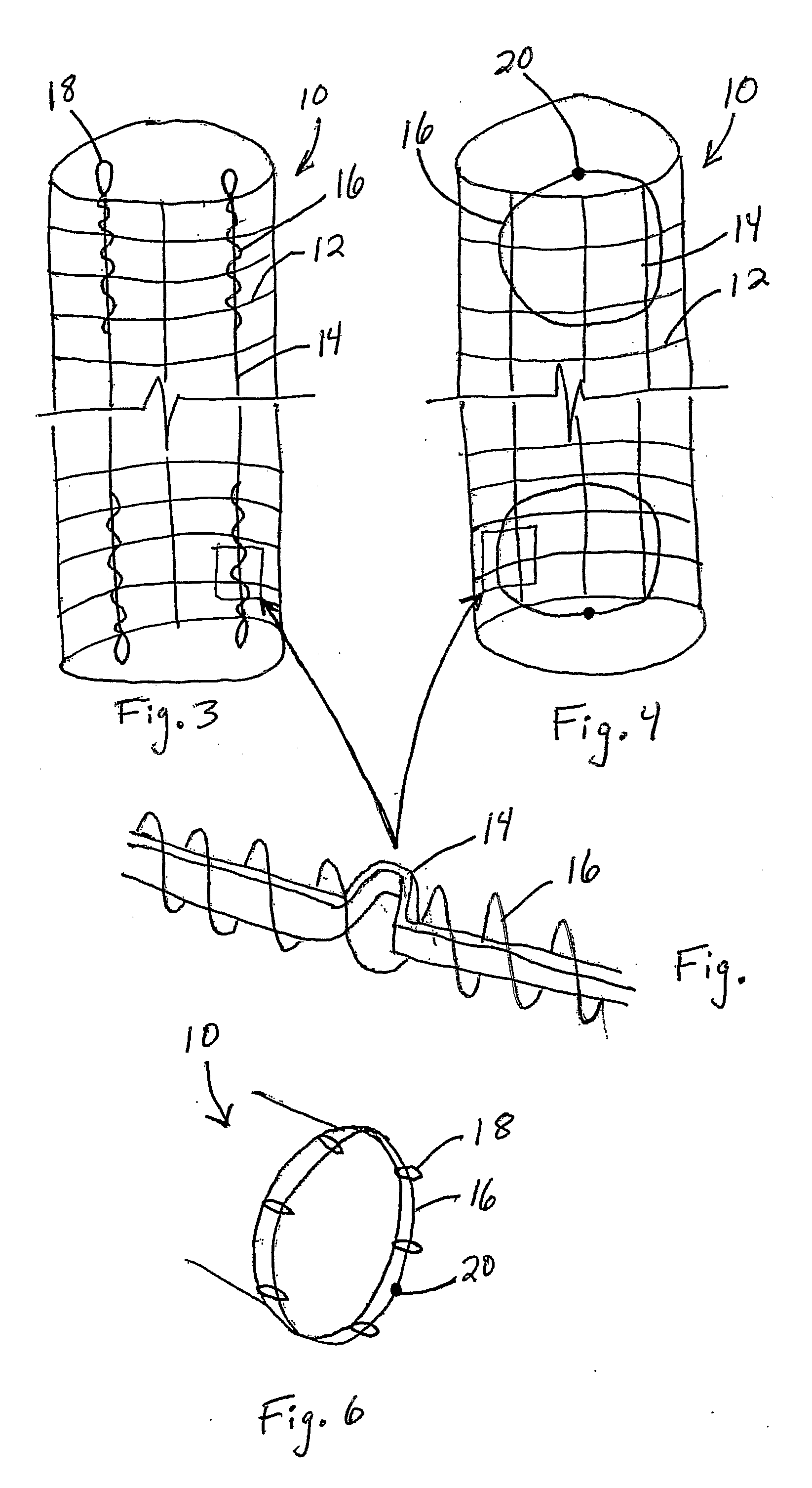 Stent Removal and Repositioning Aid and Associated Method