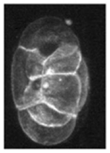 Microscope image deblurring method based on dense network