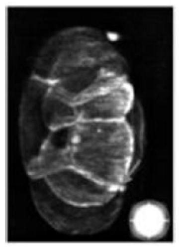 Microscope image deblurring method based on dense network