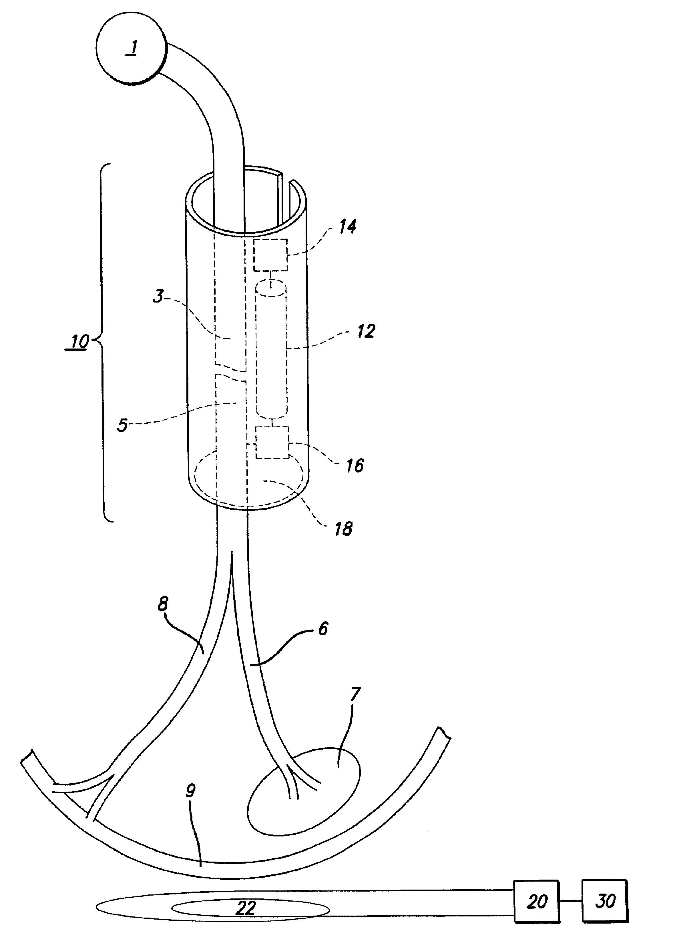 System and method for providing recovery from muscle denervation