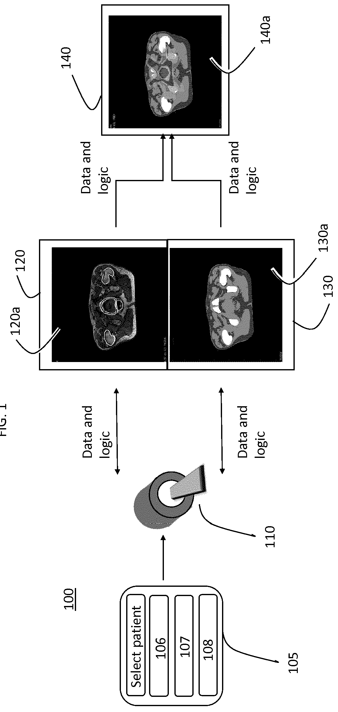 Medical product configured to be used for image based radiotheraphy planning