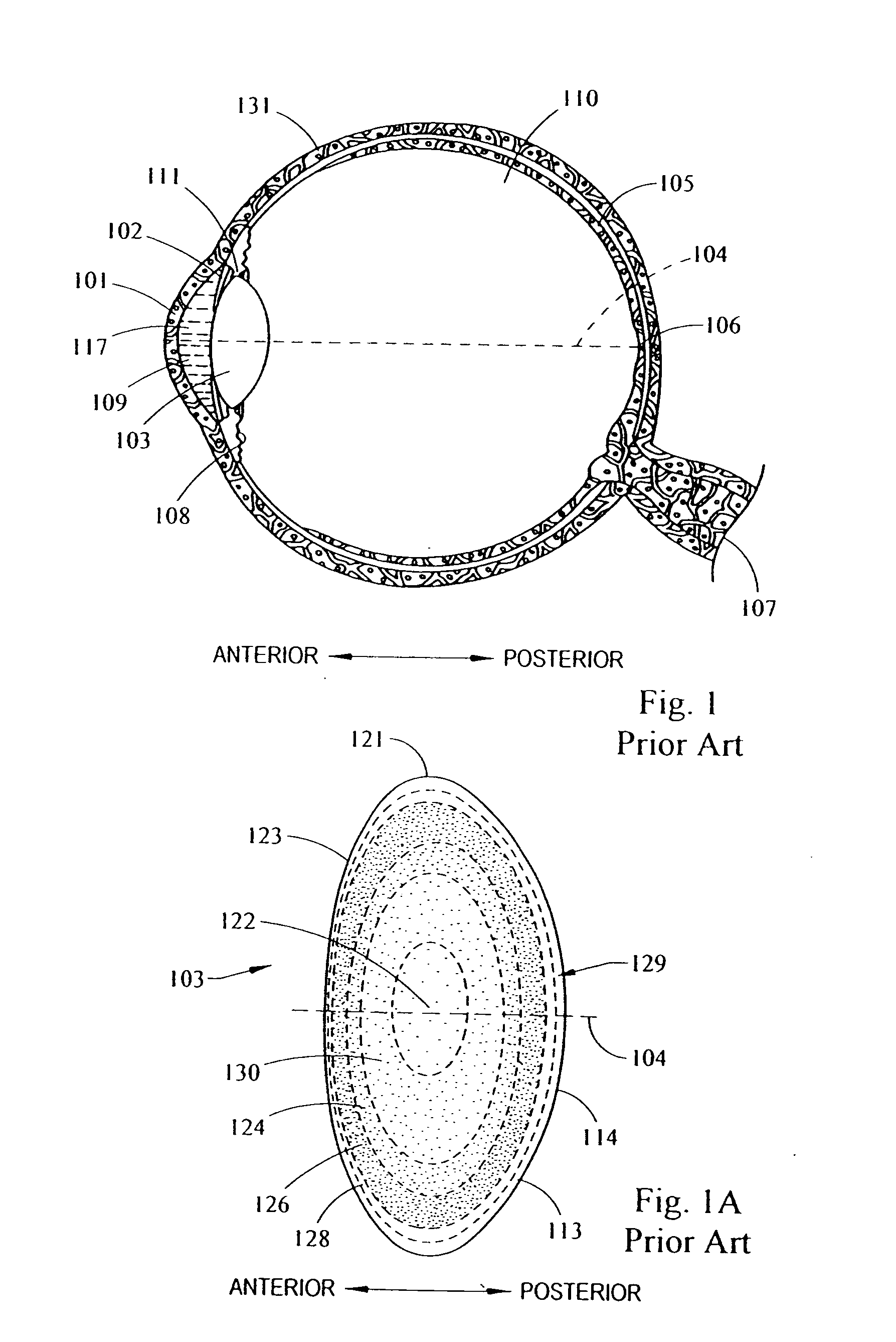 System and method for improving the accommodative amplitude and increasing the refractive power of the human lens with a laser