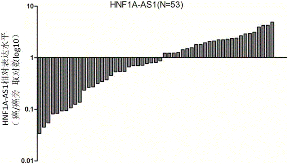 Application of long noncoding RNA HNF1A-AS1 ((hepatocyte nuclear factor-1Alpha Antisense 1) in preparation of drugs for treating human malignant solid tumors