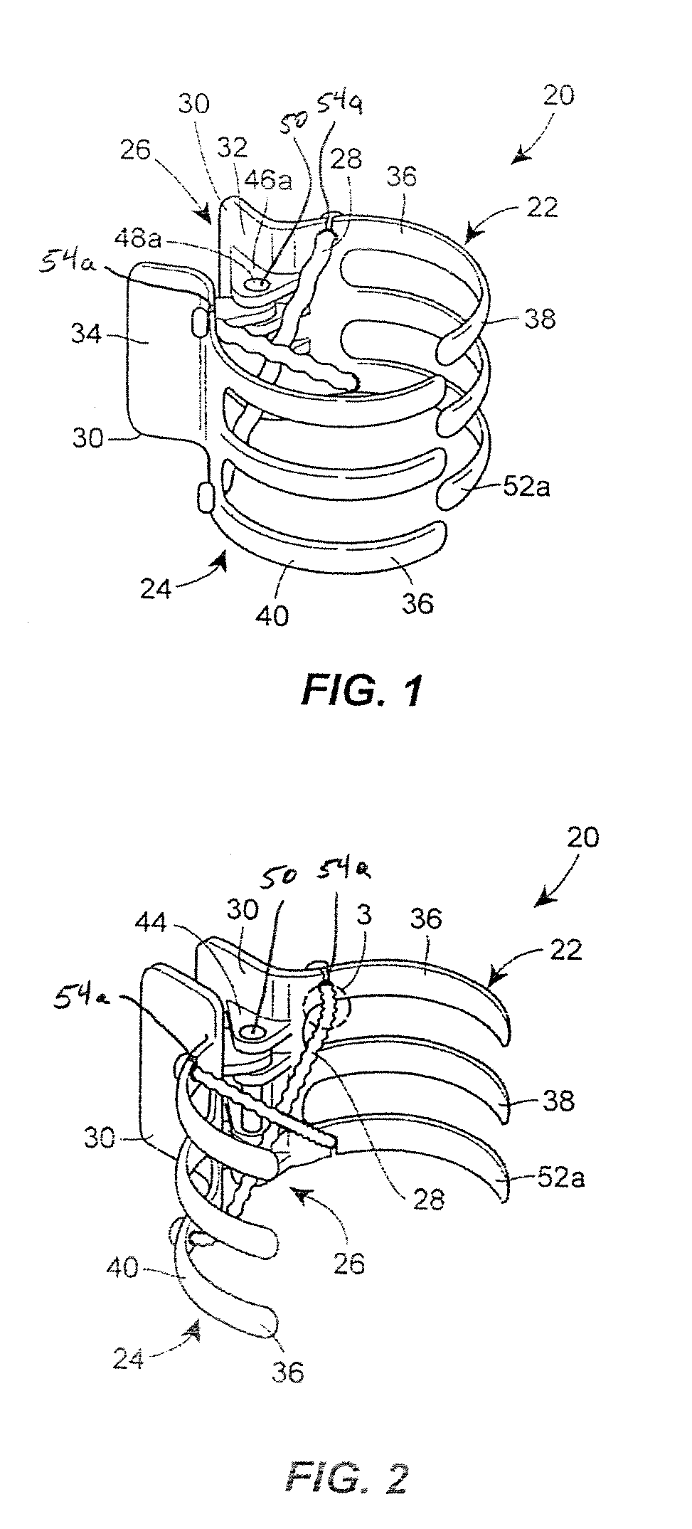 Hair Retaining Clip with Elastic Biasing Member