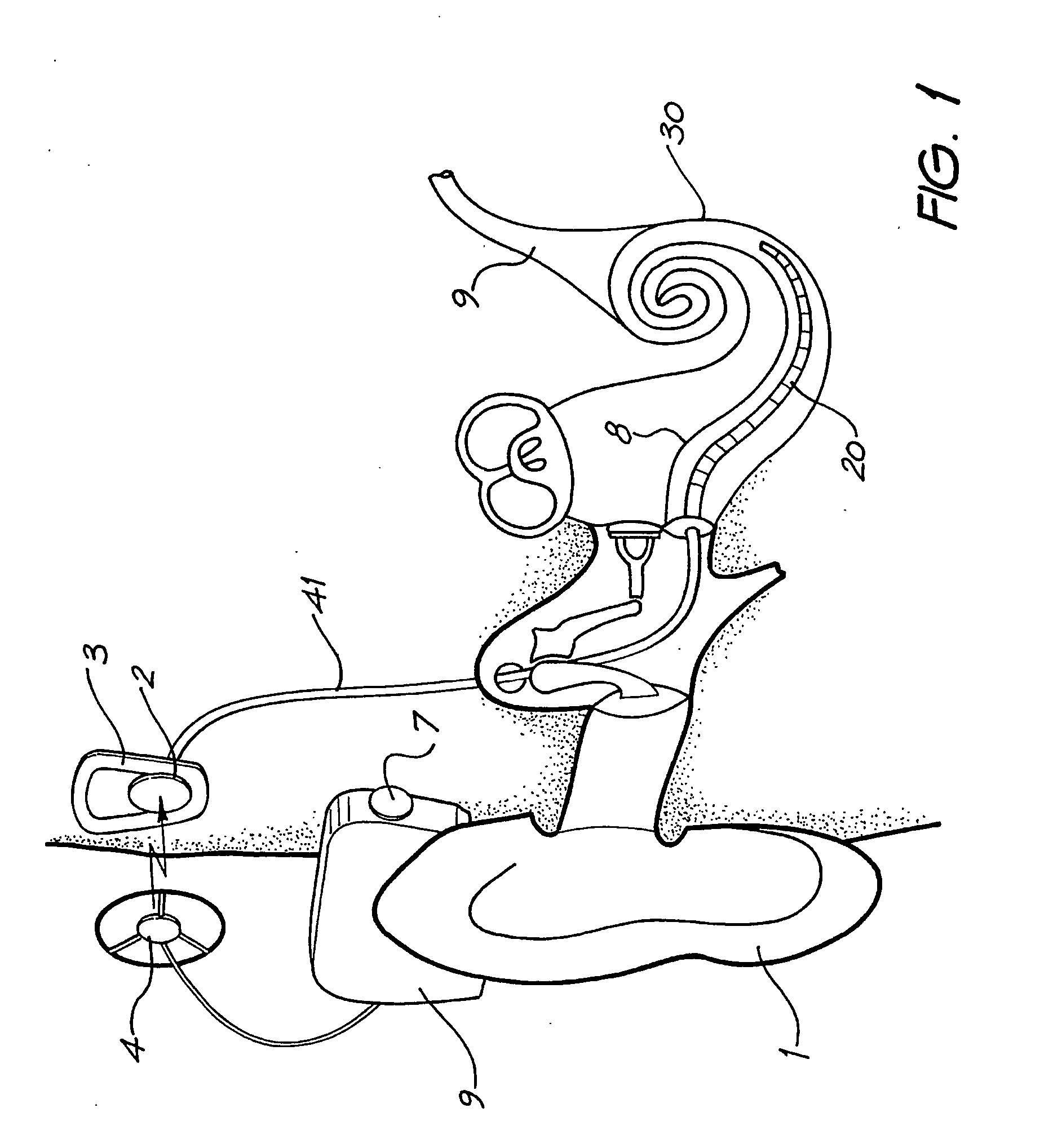 Connector for drug delivery system in cochlear implant