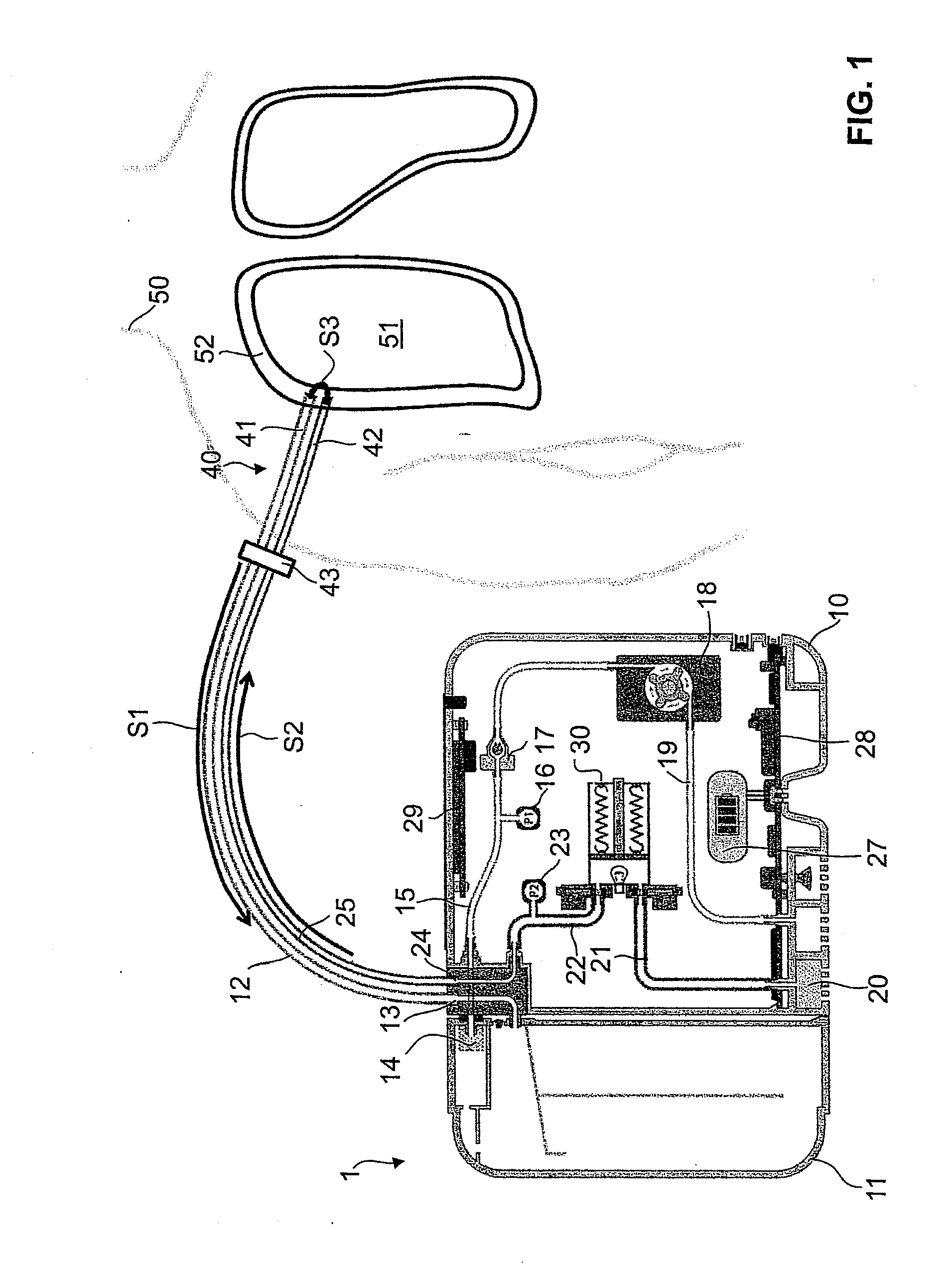 Suction Apparatus with a Flushable Drainage Line