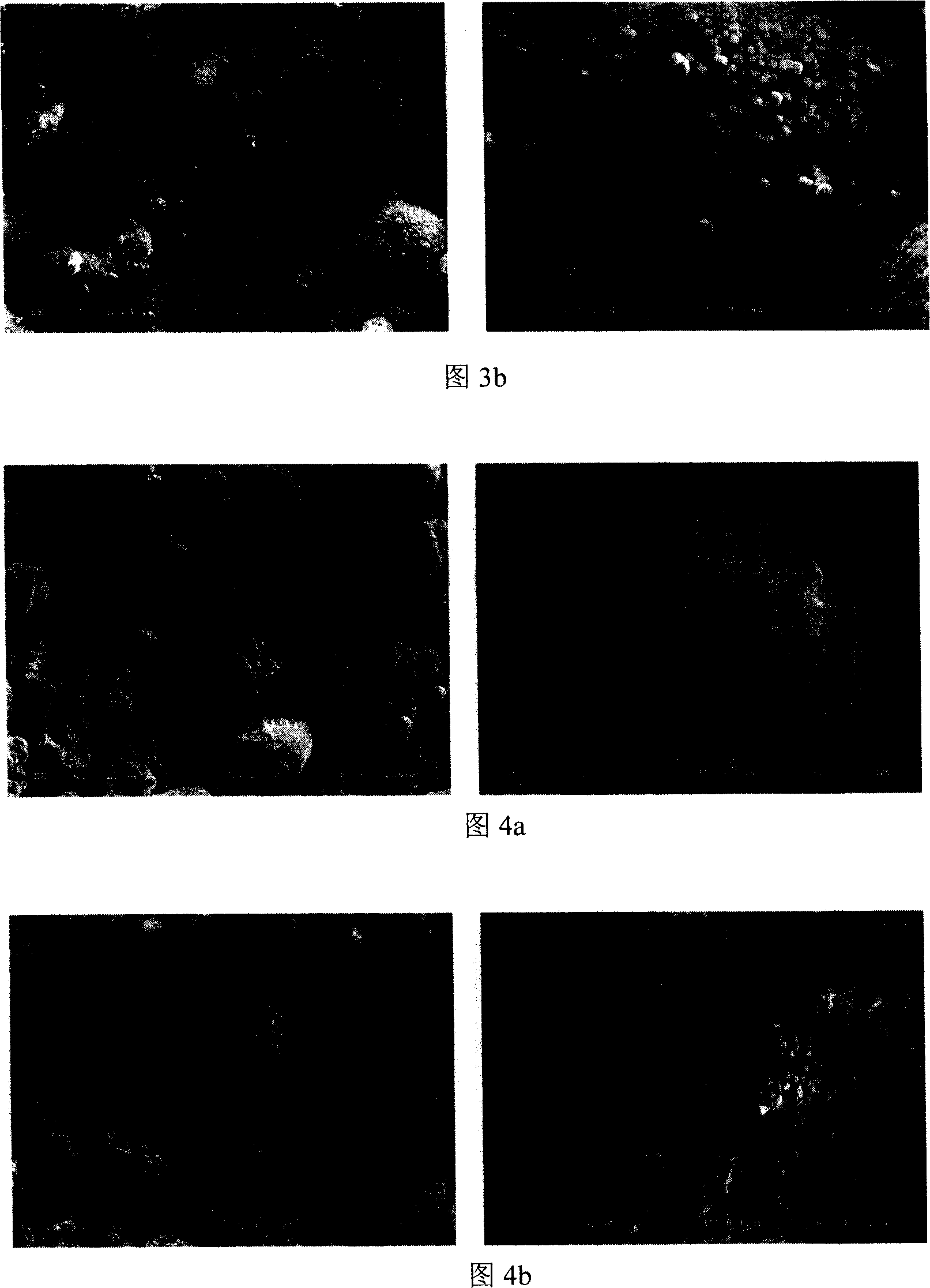 Composite powder coated by ultramicro or Nano metal powder, and preparation method