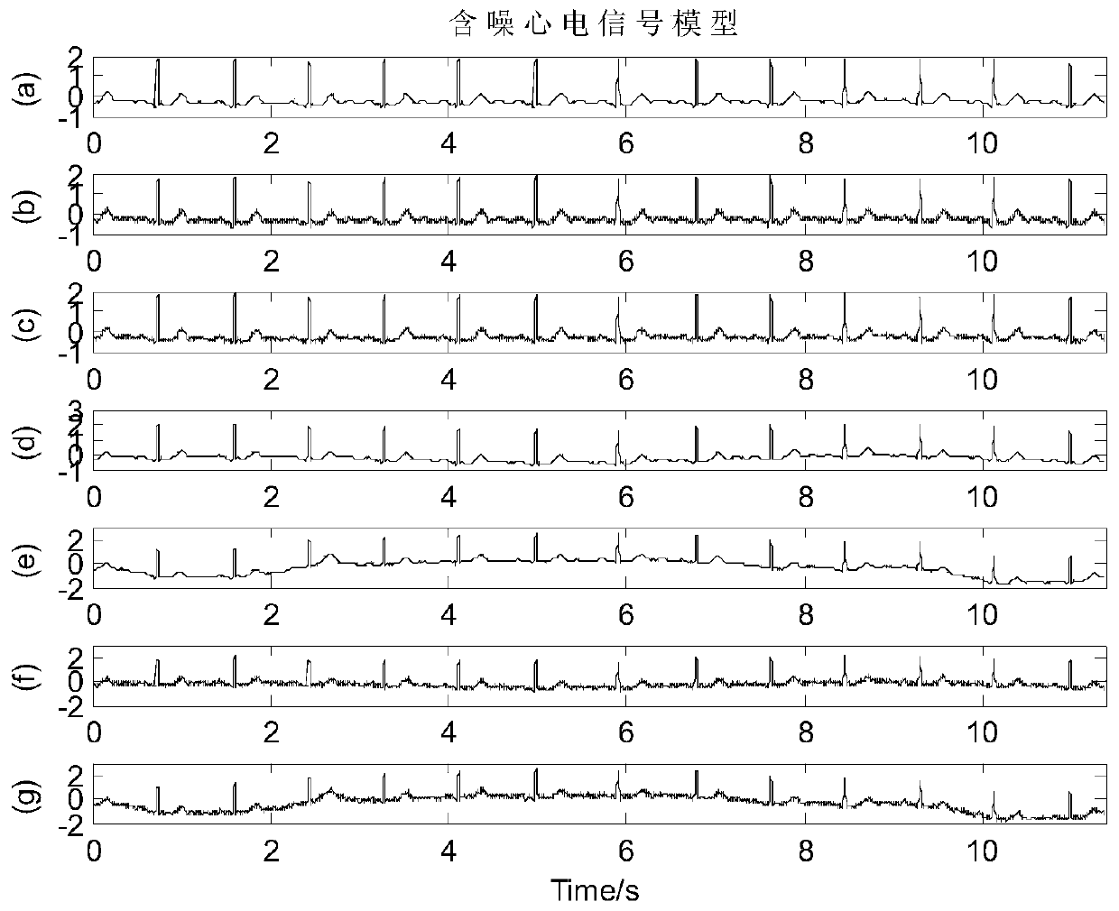 Integrated filtering method for ECG signals based on wavelet transform and improved EEMD