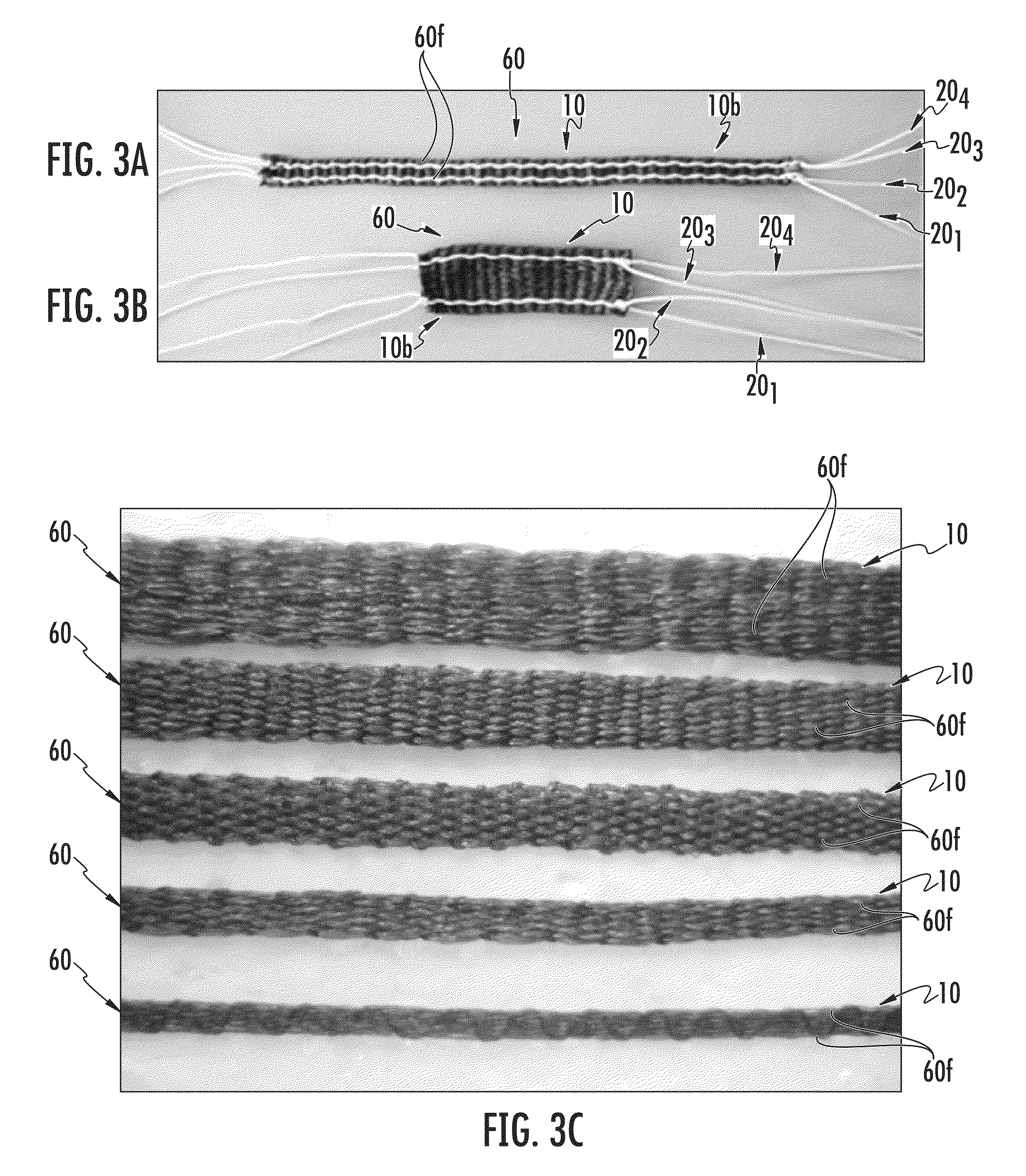 Implantable collagen devices and related methods and systems of making same