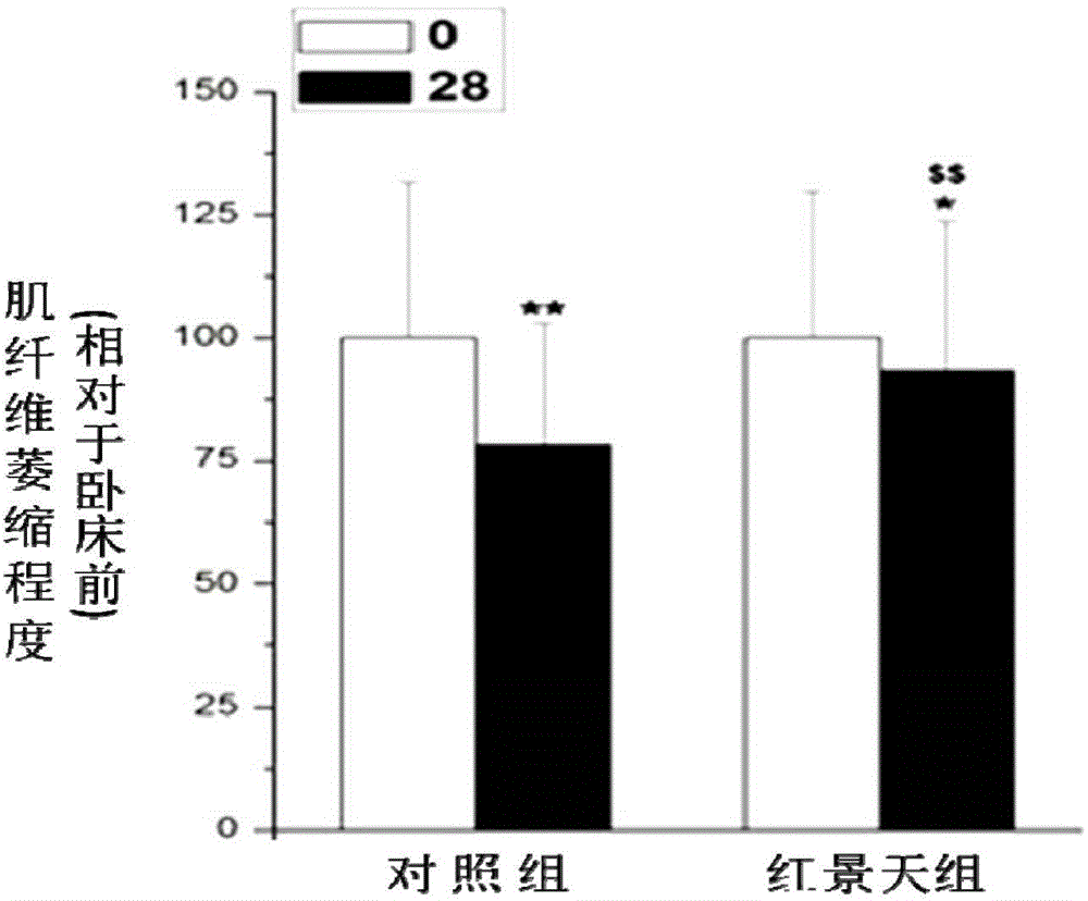 Application of rhodiola rosea in prevention and treatment of amyotrophy disease