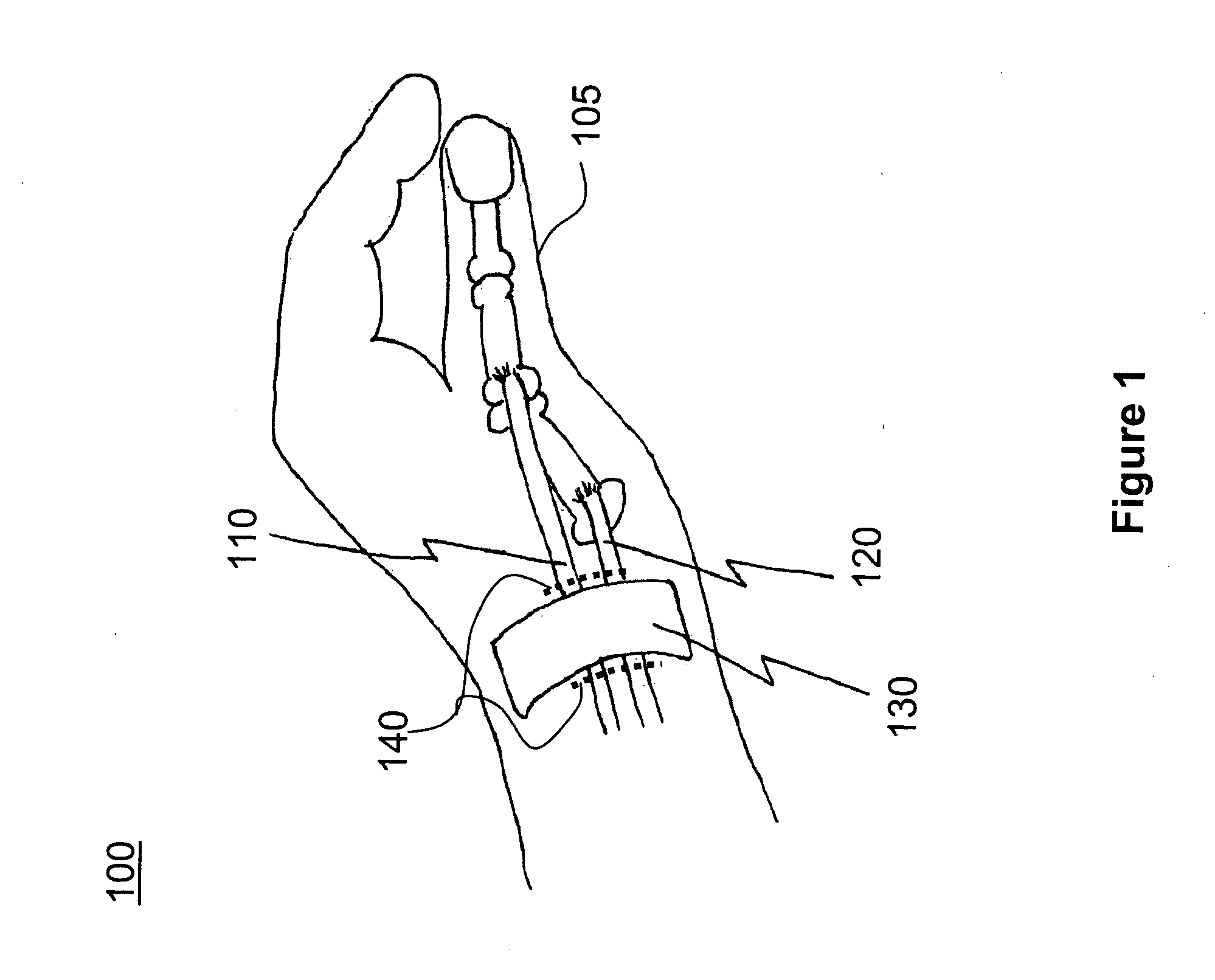 Apparatus and method for releasing tendon sheath