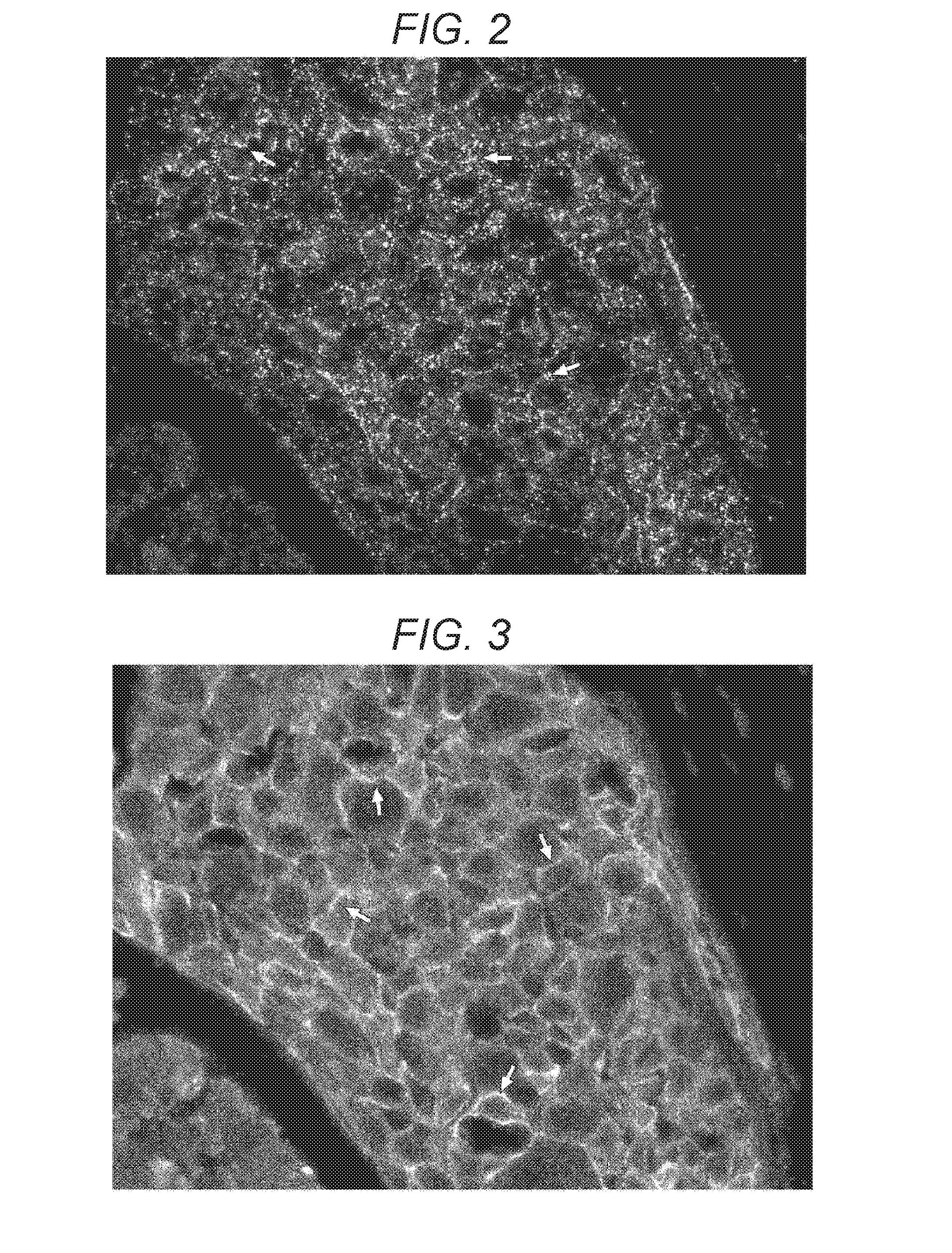 Method for quantifying biological material based on multiple immunostaining