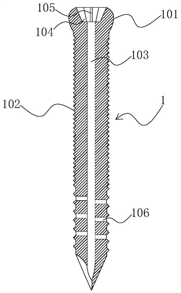 Bone cement fixation device and method