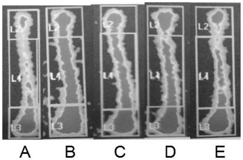 A preparation method of phosphorylated krill peptide capable of preventing and treating osteoporosis