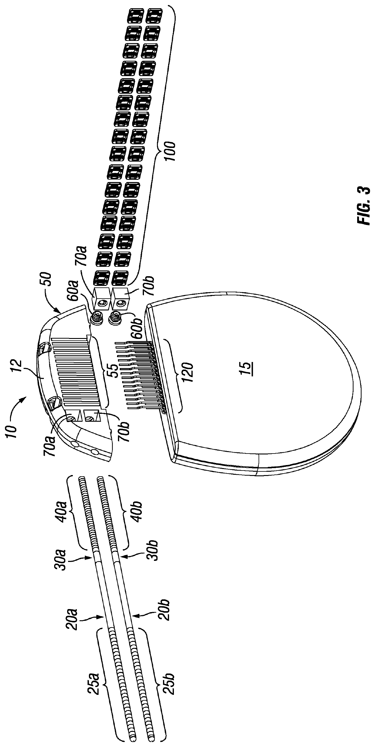 Apparatus and Device for the Electrical Interconnect of Implantable Devices